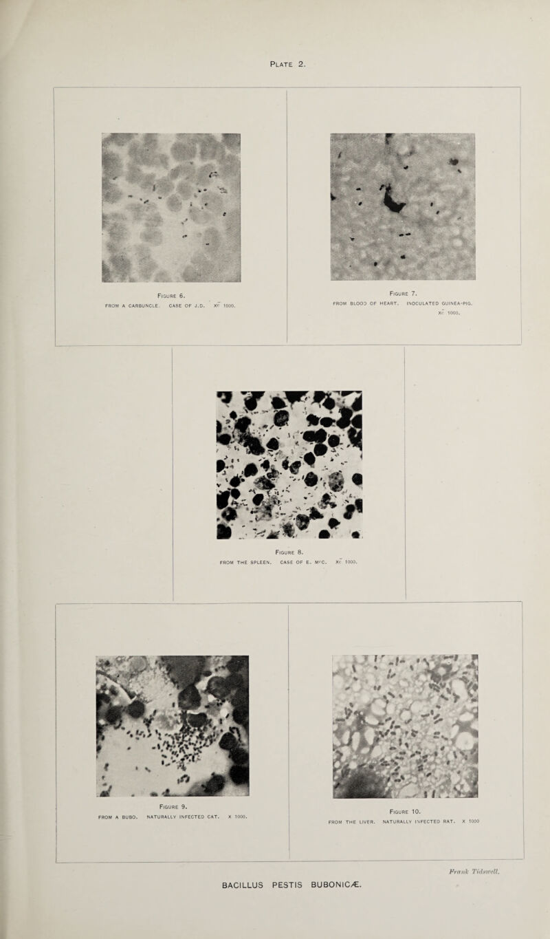 Figure 6. FROM A CARBUNCLE. CASE OF J.D. Xc 1000. Figure 7. FROM BLOOD OF HEART. INOCULATED GUINEA-PIG. Xc 1000. Figure 8. FROM THE SPLEEN. CASE OF E, MCC. Xc 1000. Frank Tid*well.
