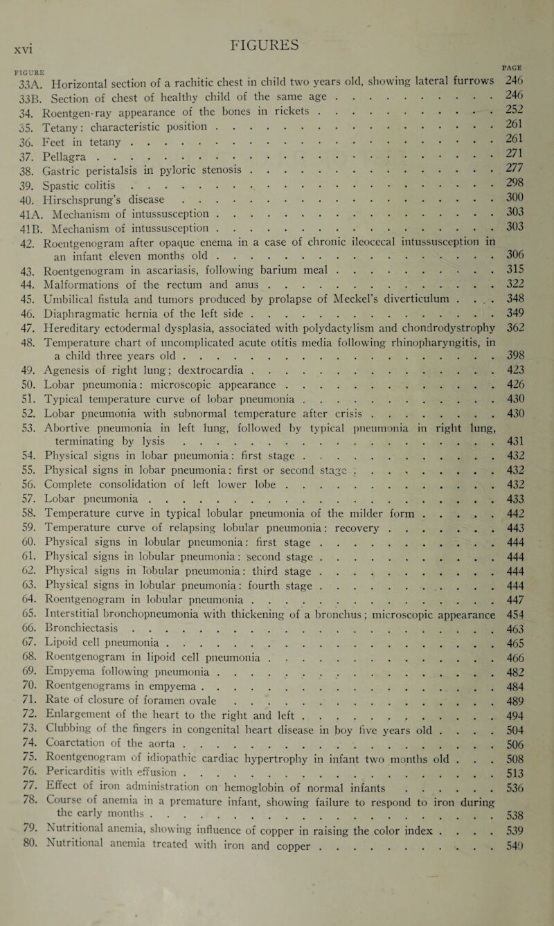 FIGURE 33A. Horizontal section of a rachitic chest in child two years old, showing lateral furrows 33B. Section of chest of healthy child of the same age. 34. Roentgen-ray appearance of the bones in rickets. 35. Tetany: characteristic position. 36. Feet in tetany. 37. Pellagra. 38. Gastric peristalsis in pyloric stenosis. 39. Spastic colitis. 40. Hirschsprung’s disease. 41A. Mechanism of intussusception. 41B. Mechanism of intussusception. 42. Roentgenogram after opaque enema in a case of chronic ileocecal intussusception in an infant eleven months old. 43. Roentgenogram in ascariasis, following barium meal. 44. Malformations of the rectum and anus. 45. Umbilical fistula and tumors produced by prolapse of Meckel’s diverticulum . . . . 46. Diaphragmatic hernia of the left side. 47. Hereditary ectodermal dysplasia, associated with polydactylism and chondrodystrophy 48. Temperature chart of uncomplicated acute otitis media following rhinopharyngitis, in a child three years old. 49. Agenesis of right lung; dextrocardia. 50. Lobar pneumonia: microscopic appearance... 51. Typical temperature curve of lobar pneumonia. 52. Lobar pneumonia with subnormal temperature after crisis. 53. Abortive pneumonia in left lung, followed by typical pneumonia in right lung, terminating by lysis. 54. Physical signs in lobar pneumonia: first stage. 55. Physical signs in lobar pneumonia: first or second stage. 56. Complete consolidation of left lower lobe. 57. Lobar pneumonia. 58. Temperature curve in typical lobular pneumonia of the milder form. 59. Temperature curve of relapsing lobular pneumonia: recovery. 60. Physical signs in lobular pneumonia: first stage. 61. Physical signs in lobular pneumonia: second stage. 62. Physical signs in lobular pneumonia: third stage. 63. Physical signs in lobular pneumonia: fourth stage. 64. Roentgenogram in lobular pneumonia. 65. Interstitial bronchopneumonia with thickening of a bronchus; microscopic appearance 66. Bronchiectasis. 67. Lipoid cell pneumonia. 68. Roentgenogram in lipoid cell pneumonia. 69. Empyema following pneumonia. 70. Roentgenograms in empyema. 71. Rate of closure of foramen ovale. 72. Enlargement of the heart to the right and left. 73. Clubbing of the fingers in congenital heart disease in boy five years old . 74. Coarctation of the aorta. 75. Roentgenogram of idiopathic cardiac hypertrophy in infant two months old . 76. Pericarditis with effusion. 77. Effect of iron administration on hemoglobin of normal infants. 78. Course of anemia in a premature infant, showing failure to respond to iron during the early months. 79. Nutritional anemia, showing influence of copper in raising the color index .... 80. Nutritional anemia treated with iron and copper. PAGE 246 246 252 261 261 271 277 298 300 303 303 306 315 322 348 349 362 398 423 426 430 430 431 432 432 432 433 442 443 444 444 444 444 447 454 463 465 466 482 484 489 494 504 506 508 513 536 538 539 540