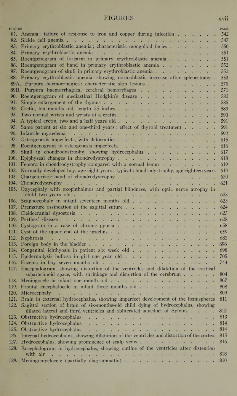 FIGURE PAGE 81. Anemia; failure of response to iron and copper during infection.542 82. Sickle cell anemia.547 83. Primary erythroblastic anemia; characteristic mongoloid facies.550 84. Primary erythroblastic anemia.551 85. Roentgenogram of forearm in primary erythroblastic anemia.551 86. Roentgenogram of hand in primary erythroblastic anemia.552 87. Roentgenogram of skull in primary erythroblastic anemia.552 88. Primary erythroblastic anemia, showing normoblastic increase after splenectomy . 553 89A. Purpura haemorrhagica: characteristic skin lesions.570 89B. Purpura haemorrhagica, cerebral hemorrhages.571 90. Roentgenogram of mediastinal Hodgkin’s disease.582 91. Simple enlargement of the thymus.585 92. Cretin, ten months old, length 25 inches.589 93. Two normal wrists and wrists of a cretin.590 94. A typical cretin, two and a half years old.591 95. Same patient at six and one-third years: effect of thyroid treatment.591 96. Infantile myxedema.592 97. Osteogenesis imperfecta, with deformities . . . .615 98. Roentgenogram in osteogenesis imperfecta.616 99. Skull in chondrodystrophy, showing hydrocephalus.617 100. Epiphyseal changes in chondrodystrophy.618 101. Femora in chondrodystrophy compared with a normal femur.619 102. Normally developed boy, age eight years; typical chondrodystrophy, age eighteen years 619 103. Characteristic hand of chondrodystrophy .... 620 104. Chondrodystrophy.621 105. Oxycephaly with exophthalmos and partial blindness, with optic nerve atrophy in child two years old.623 106. Scaphocephaly in infant seventeen months old. 623 107. Premature ossification of the sagittal suture.624 108. Cleidocranial dysostosis.625 109. Perthes’ disease.628 110. Cystogram in a case of chronic pyuria.658 111. Cyst of the upper end of the urachus.659 112. Nephrosis.685 113. Foreign body in the bladder.696 114. Congenital ichthyosis in patient six week old.698 115. Epidermolysis bullosa in girl one year old.705 116. Eczema in boy seven months old.744 117. Encephalogram, showing distortion of the ventricles and dilatation of the cortical subarachnoid space, with shrinkage and distortion of the cerebrum.804 118. Meningocele in infant one month old.807 119. Frontal encephalocele in infant three months old.808 120. Microcephaly.809 121. Brain in external hydrocephalus, showing imperfect development of the hemispheres 811 122. Sagittal section of brain of six-months-old child dying of hydrocephalus, showing dilated lateral and third ventricles and obliterated aqueduct of Sylvius .... 812 123. Obstructive hydrocephalus.813 124. Obstructive hydrocephalus.-.814 125. Obstructive hydrocephalus.814 126. Internal hydrocephalus, showing dilatation of the ventricles and distortion of the cortex 815 127. Hydrocephalus, showing prominence of scalp veins.816 128. Encephalogram in hydrocephalus, showing outline of the ventricles after distention with air.818 129. Meningomyelocele (partially diagrammatic). 820