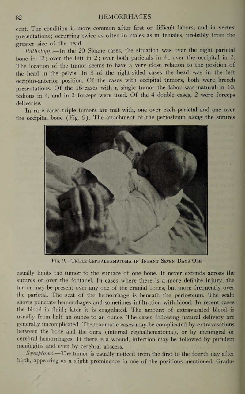 cent. The condition is more common after first or difficult labors, and in vertex presentations; occurring twice as often in males as in females, probably from the greater size of the head. Pathology.—In the 20 Sloane cases, the situation was over the right parietal bone in 12; over the left in 2; over both parietals in 4; over the occipital in 2. The location of the tumor seems to have a very close relation to the position of the head in the pelvis. In 8 of the right-sided cases the head was in the left occipito-anterior position. Of the cases with occipital tumors, both were breech presentations. Of the 16 cases with a single tumor the labor was natural in 10, tedious in 4, and in 2 forceps were used. Of the 4 double cases, 2 were forceps deliveries. In rare cases triple tumors are met with, one over each parietal and .one over the occipital bone (Fig. 9). The attachment of the periosteum along the sutures Fig. 9.—Triple Cephalhematoma in Infant Seven Days Old. usually limits the tumor to the surface of one bone. It never extends across the sutures or over the fontanel. In cases where there is a more definite injury, the tumor may be present over any one of the cranial bones, but more frequently over the parietal. The seat of the hemorrhage is beneath the periosteum. The scalp shows punctate hemorrhages and sometimes infiltration with blood. In recent cases the blood is fluid; later it is coagulated. The amount of extravasated blood is usually from half an ounce to an ounce. The cases following natural delivery are generally uncomplicated. The traumatic cases may be complicated by extravasations between the bone and the dura (internal cephalhematoma), or by meningeal or cerebral hemorrhages. If there is a wound, infection may be followed by purulent meningitis and even by cerebral abscess. Symptoms.—The tumor is usually noticed from the first to the fourth day after birth, appearing as a slight prominence in one of the positions mentioned. Gradu-