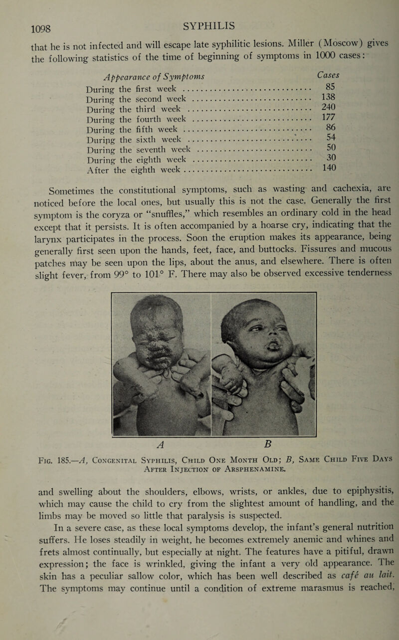 that he is not infected and will escape late syphilitic lesions. Miller (Moscow) gives the following statistics of the time of beginning of symptoms in 1000 cases: Appearance of Symptoms During the first week . During the second week . .. During the third week .... During the fourth week . .. During the fifth week . During the sixth week .... During the seventh week .. During the eighth week . .. After the eighth week. Cases 85 138 240 177 86 54 50 30 140 Sometimes the constitutional symptoms, such as wasting and cachexia, are noticed before the local ones, but usually this is not the case. Generally the first symptom is the coryza or “snuffles,” which resembles an ordinary cold in the head except that it persists. It is often accompanied by a hoarse cry, indicating that the larynx participates in the process. Soon the eruption makes its appearance, being generally first seen upon the hands, feet, face, and buttocks. Fissures and mucous patches may be seen upon the lips, about the anus, and elsewhere. There is often slight fever, from 99° to 101° F. There may also be observed excessive tenderness A B Fig. 185.—A, Congenital Syphilis, Child One Month Old; B, Same Child Five Days After Injection of Arsphenamine. and swelling about the shoulders, elbows, wrists, or ankles, due to epiphysitis, which may cause the child to cry from the slightest amount of handling, and the limbs may be moved so little that paralysis is suspected. In a severe case, as these local symptoms develop, the infant’s general nutrition suffers. He loses steadily in weight, he becomes extremely anemic and whines and frets almost continually, but especially at night. The features have a pitiful, drawn expression; the face is wrinkled, giving the infant a very old appearance. I he skin has a peculiar sallow color, which has been well described as cafe an lait. The symptoms may continue until a condition of extreme marasmus is reached,