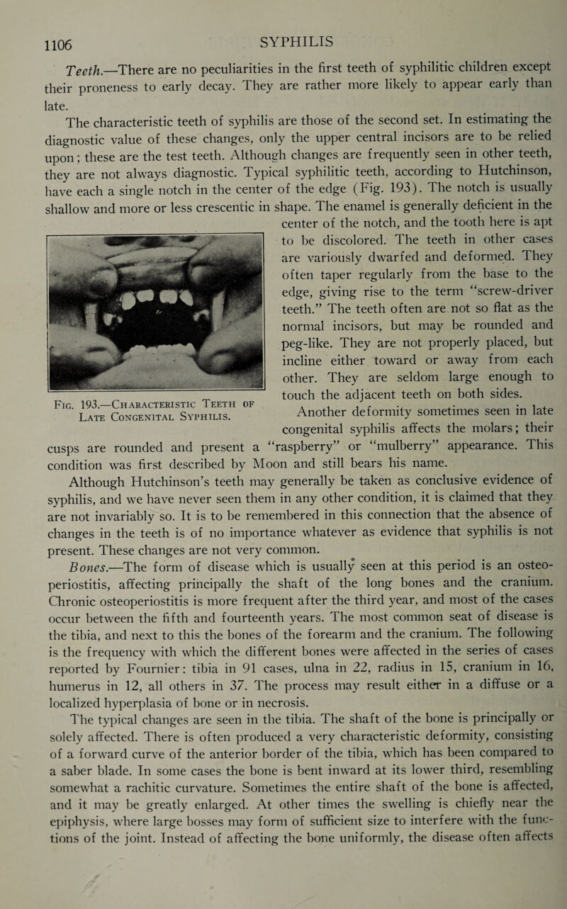 Teeth.—There are no peculiarities in the first teeth of syphilitic children except their proneness to early decay. They are rather more likely to appear early than late. The characteristic teeth of syphilis are those of the second set. In estimating the diagnostic value of these changes, only the upper central incisors are to be relied upon; these are the test teeth. Although changes are frequently seen in other teeth, they are not always diagnostic. Typical syphilitic teeth, according to Hutchinson, have each a single notch in the center of the edge (Fig. 193). The notch is usually shallow and more or less crescentic in shape. The enamel is generally deficient in the center of the notch, and the tooth here is apt to be discolored. The teeth in other cases are variously dwarfed and deformed. They often taper regularly from the base to the edge, giving rise to the term “screw-driver teeth.” The teeth often are not so flat as the normal incisors, but may be rounded and peg-like. They are not properly placed, but incline either toward or away from each other. They are seldom large enough to touch the adjacent teeth on both sides. Another deformity sometimes seen in late congenital syphilis affects the molars; their cusps are rounded and present a “raspberry” or “mulberry” appearance. This condition was first described by Moon and still bears his name. Although Hutchinson’s teeth may generally be taken as conclusive evidence of syphilis, and we have never seen them in any other condition, it is claimed that they are not invariably so. It is to be remembered in this connection that the absence of changes in the teeth is of no importance whatever as evidence that syphilis is not present. These changes are not very common. Bones.—The form of disease which is usually seen at this period is an osteo¬ periostitis, affecting principally the shaft of the long bones and the cranium. Chronic osteoperiostitis is more frequent after the third year, and most of the cases occur between the fifth and fourteenth years. The most common seat of disease is the tibia, and next to this the bones of the forearm and the cranium. The following is the frequency with which the different bones were affected in the series of cases reported by Fournier: tibia in 91 cases, ulna in 22, radius in 15, cranium in 16, humerus in 12, all others in 37. The process may result either in a diffuse or a localized hyperplasia of bone or in necrosis. 31ie typical changes are seen in the tibia. The shaft of the bone is principally or solely affected. There is often produced a very characteristic deformity, consisting of a forward curve of the anterior border of the tibia, which has been compared to a saber blade. In some cases the bone is bent inward at its lower third, resembling somewhat a rachitic curvature. Sometimes the entire shaft of the bone is affected, and it may be greatly enlarged. At other times the swelling is chiefly near the epiphysis, where large bosses may form of sufficient size to interfere with the func¬ tions of the joint. Instead of affecting the bone uniformly, the disease often affects