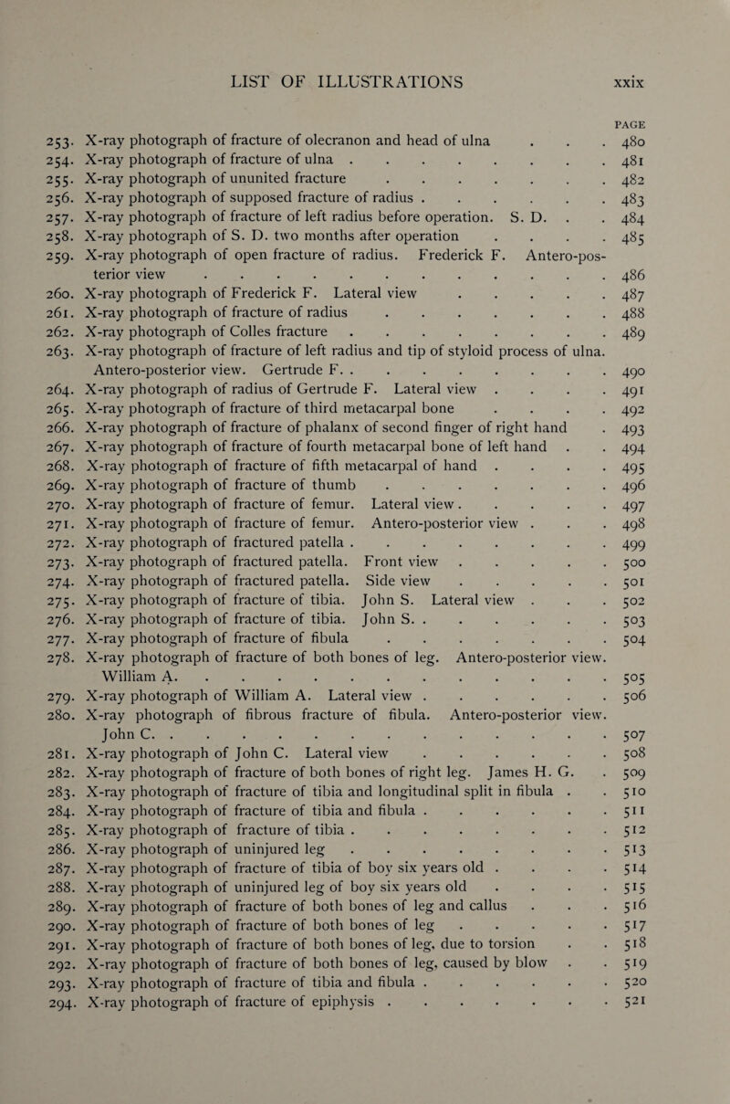 253. X-ray photograph of fracture of olecranon and head of ulna 254. X-ray photograph of fracture of ulna ....... 255. X-ray photograph of ununited fracture ...... 256. X-ray photograph of supposed fracture of radius ..... 257. X-ray photograph of fracture of left radius before operation. S. D. 258. X-ray photograph of S. D. two months after operation 259. X-ray photograph of open fracture of radius. Frederick F. Antero-pos terior view ........... 260. X-ray photograph of Frederick F. Lateral view .... 261. X-ray photograph of fracture of radius ...... 262. X-ray photograph of Colles fracture ....... 263. X-ray photograph of fracture of left radius and tip of styloid process of ulna Antero-posterior view. Gertrude F. . 264. X-ray photograph of radius of Gertrude F. Lateral view 265. X-ray photograph of fracture of third metacarpal bone 266. X-ray photograph of fracture of phalanx of second finger of right hand 267. X-ray photograph of fracture of fourth metacarpal bone of left hand 268. X-ray photograph of fracture of fifth metacarpal of hand 269. X-ray photograph of fracture of thumb ...... 270. X-ray photograph of fracture of femur. Lateral view .... 271. X-ray photograph of fracture of femur. Antero-posterior view . 272. X-ray photograph of fractured patella ....... 273. X-ray photograph of fractured patella. Front view .... 274. X-ray photograph of fractured patella. Side view .... 275. X-ray photograph of fracture of tibia. John S. Lateral view . 276. X-ray photograph of fracture of tibia. John S. . 277. X-ray photograph of fracture of fibula ...... 278. X-ray photograph of fracture of both bones of leg. Antero-posterior view William A. .......... 279. X-ray photograph of William A. Lateral view ..... 280. X-ray photograph of fibrous fracture of fibula. Antero-posterior view John C. ........... 281. X-ray photograph of John C. Lateral view ..... 282. X-ray photograph of fracture of both bones of right leg. James H. G. 283. X-ray photograph of fracture of tibia and longitudinal split in fibula . 284. X-ray photograph of fracture of tibia and fibula ..... 285. X-ray photograph of fracture of tibia ....... 286. X-ray photograph of uninjured leg ....... 287. X-ray photograph of fracture of tibia of boy six years old . 288. X-ray photograph of uninjured leg of boy six years old 289. X-ray photograph of fracture of both bones of leg and callus 290. X-ray photograph of fracture of both bones of leg .... 291. X-ray photograph of fracture of both bones of leg, due to torsion 292. X-ray photograph of fracture of both bones of leg, caused by blow 293. X-ray photograph of fracture of tibia and fibula ..... 294. X-ray photograph of fracture of epiphysis. PAGE 480 481 482 483 484 485 486 487 488 489 490 491 492 493 494 495 496 497 498 499 500 501 502 503 504 5°5 506 5°7 508 5°9 510 511 512 513 5H 515 516 517 518 5*9 520 521