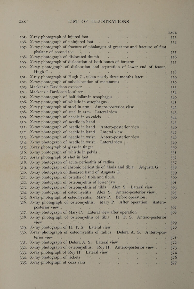 PAGE 295. X-ray photograph of injured foot ........ 523 296. X-ray photograph of uninjured foot ........ 524 297. X-ray photograph of fracture of phalanges of great toe and fracture of first phalanx of second toe . . . . . . . . . *525 298. X-ray photograph of dislocated thumb ....... 526 299. X-ray photograph of dislocation of both bones of forearm .... 527 300. X-ray photograph of dislocation and separation of lower end of femur. Hugh C. ............ 528 301. X-ray photograph of Hugh C., taken nearly three months later . . . 529 302. X-ray photograph of subdislocation of metatarsus ..... 530 303. Mackenzie Davidson exposer ......... 533 304. Mackenzie Davidson localizer ......... 534 305. X-ray photograph of half dollar in oesophagus ...... 540 306. X-ray photograph of whistle in oesophagus ....... 541 307. X-ray photograph of steel in arm. Antero-posterior view .... 542 308. X-ray photograph of steel in arm. Lateral view ..... 543 309. X-ray photograph of needle in os calcis ....... 544 310. X-ray photograph of needle in hand ........ 545 311. X-ray photograph of needle in hand. Antero-posterior view . . . 546 312. X-ray photograph of needle in hand. Lateral view . . . . 547 313. X-ray photograph of needle in wrist. Antero-posterior view . . . 548 314. X-ray photograph of needle in wrist. Lateral view ..... 549 315. X-ray photograph of glass in finger . . . . . . . 550 316. X-ray photograph of whistle in pelvis ........ 551 317. X-ray photograph of shot in foot . . . . . . . -552 318. X-ray photograph of acute periostitis of radius . . . . . -557 319. X-ray photograph of chronic periostitis of fibula and tibia. Augusta G. . 558 320. X-ray photograph of diseased hand of Augusta G. .... . 559 321. X-ray photograph of osteitis of tibia and fibula . . ... . . 560 322. X-ray photograph of osteomyelitis of lower jaw ...... 561 323. X-ray photograph of osteomyelitis of tibia. Alex. S. Lateral view . . 563 324. X-ray photograph of osteomyelitis. Alex. S. Antero-posterior view. . 565 325. X-ray photograph of osteomyelitis. Mary P. Before operation . . . 566 326. X-ray photograph of osteomyelitis. Mary P. After operation. Antero¬ posterior view ............ 567 327. X-ray photograph of Mary P. Lateral view after operation . . . 568 328. X-ray photograph of osteomyelitis of tibia. H. T. S. Antero-posterior view ............. 569 329. X-ray photograph of H. T. S. Lateral view . . . . . . 570 330. X-ray photograph of osteomyelitis of radius. Delora A. S. Antero-pos¬ terior view . . . . . . . . . . . 571 331. X-ray photograph of Delora A. S. Lateral view ..... 572 332. X-ray photograph of osteomyelitis. Roy H. Antero-posterior view . . 573 333. X-ray photograph of Roy H. Lateral view . . . . . -574 334. X-ray photograph of rickets ........ 576 335. X-ray photograph of coxa vara ......... 577