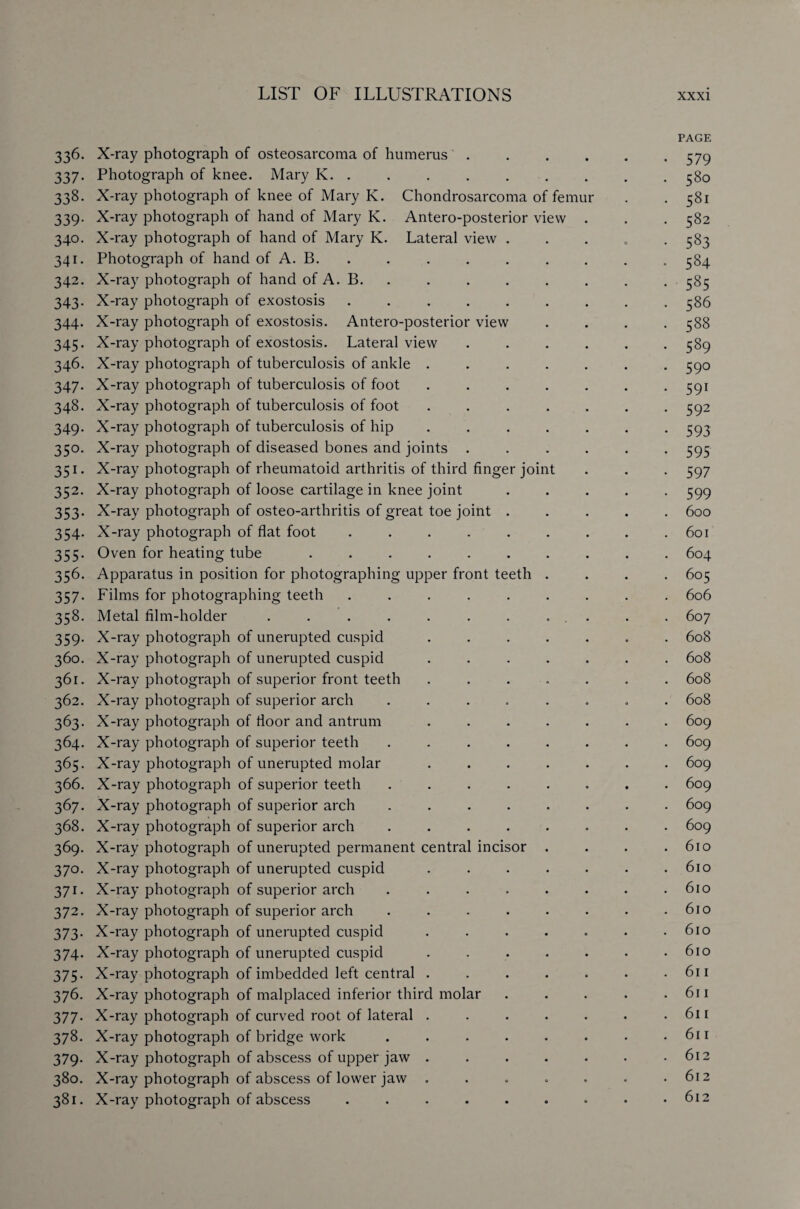 PAGE 336. X-ray photograph of osteosarcoma of humerus.579 337. Photograph of knee. Mary K. ........ 380 338. X-ray photograph of knee of Mary K. Chondrosarcoma of femur . .581 339. X-ray photograph of hand of Mary K. Antero-posterior view . . .582 340. X-ray photograph of hand of Mary K. Lateral view . 383 341. Photograph of hand of A. B. . . . . . . . . 384 342. X-ray photograph of hand of A. B. . . . . . . . 383 343. X-ray photograph of exostosis . . . . . . . . .586 344. X-ray photograph of exostosis. Antero-posterior view .... 388 345. X-ray photograph of exostosis. Lateral view ...... 389 346. X-ray photograph of tuberculosis of ankle ....... 390 347. X-ray photograph of tuberculosis of foot ....... 391 348. X-ray photograph of tuberculosis of foot ....... 392 349. X-ray photograph of tuberculosis of hip ....... 393 350. X-ray photograph of diseased bones and joints ...... 393 351. X-ray photograph of rheumatoid arthritis of third finger joint . . . 597 352. X-ray photograph of loose cartilage in knee joint ..... 399 353. X-ray photograph of osteo-arthritis of great toe joint ..... 600 354. X-ray photograph of flat foot ......... 601 355. Oven for heating tube .......... 604 356. Apparatus in position for photographing upper front teeth .... 605 357. Films for photographing teeth ......... 606 358. Metal film-holder . . . . . . . . . . 607 359. X-ray photograph of unerupted cuspid ....... 608 360. X-ray photograph of unerupted cuspid ....... 608 361. X-ray photograph of superior front teeth ....... 608 362. X-ray photograph of superior arch ........ 608 363. X-ray photograph of floor and antrum ....... 609 364. X-ray photograph of superior teeth ........ 609 365. X-ray photograph of unerupted molar ....... 609 366. X-ray photograph of superior teeth ........ 609 367. X-ray photograph of superior arch ........ 609 368. X-ray photograph of superior arch ........ 609 369. X-ray photograph of unerupted permanent central incisor . . . .610 370. X-ray photograph of unerupted cuspid . . . . • . .610 371. X-ray photograph of superior arch ........ 610 372. X-ray photograph of superior arch . . . . . . . .610 373. X-ray photograph of unerupted cuspid ....... 610 374. X-ray photograph of unerupted cuspid . . . . . . .610 375. X-ray photograph of imbedded left central . . . . . • .611 376. X-ray photograph of malplaced inferior third molar . . . . .611 377. X-ray photograph of curved root of lateral . . . . . • .611 378. X-ray photograph of bridge work . . . . . . . .611 379. X-ray photograph of abscess of upper jaw ....... 612 380. X-ray photograph of abscess of lower jaw . . . . . . .612 381. X-ray photograph of abscess . . . . . . - ♦ .612