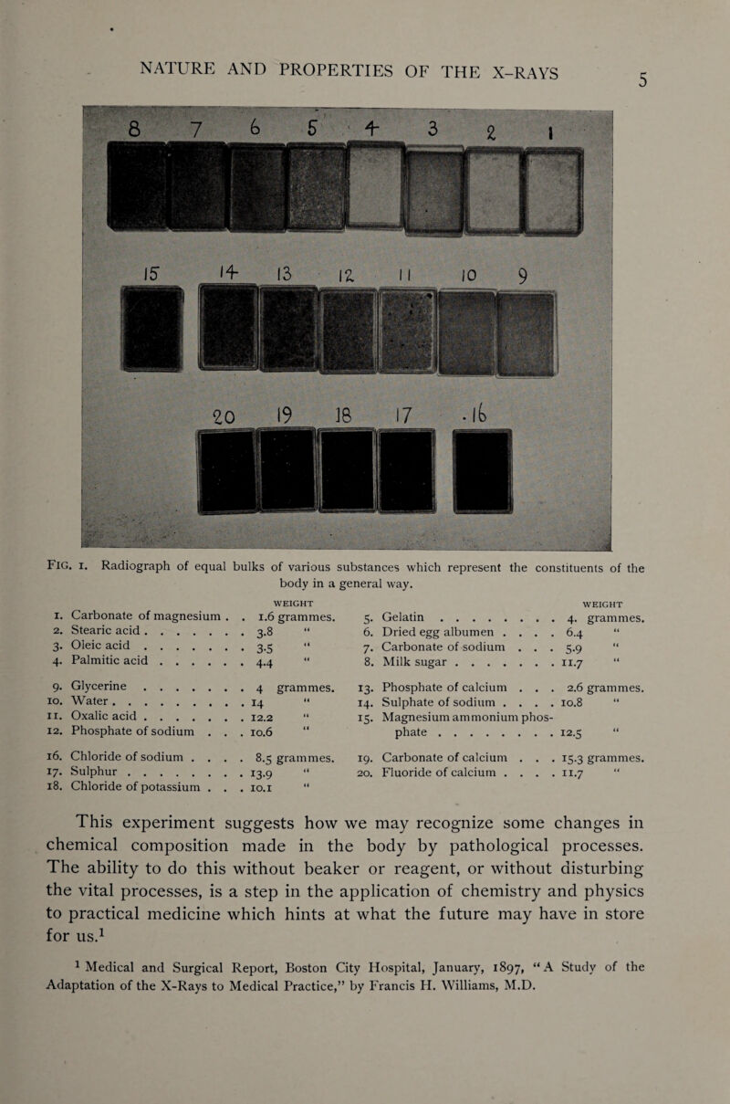 5 20 19 18 17 -ife Fig. i. Radiograph of equal bulks of various substances which represent the constituents of the body in a general way. I. Carbonate of magnesium . WEIGHT . 1.6 grammes. 5- Gelatin. WEIGHT 2. Stearic acid. . 3-8 6. Dried egg albumen .... 6.4 “ 3- Oleic acid. 7- Carbonate of sodium . . . 5-9 4- Palmitic acid. . 4.4 8. Milk sugar. 11.7 “ 9- Glycerine. . 4 grammes. 13- Phosphate of calcium . . . 2.6 grammes. 10. Water. . 14 14. Sulphate of sodium .... 10.8 11. Oxalic acid. I5- Magnesium ammonium phos- 12. Phosphate of sodium . . . 10.6 phate. 12.5 16. Chloride of sodium . . . . 8.5 grammes. 19. Carbonate of calcium . . . 15.3 grammes. 17- Sulphur. . 13.9 20. Fluoride of calcium . . . . 11.7 “ 18. Chloride of potassium . . . 10.1 “ This experiment suggests how we may recognize some changes in chemical composition made in the body by pathological processes. The ability to do this without beaker or reagent, or without disturbing the vital processes, is a step in the application of chemistry and physics to practical medicine which hints at what the future may have in store for us.1 1 Medical and Surgical Report, Boston City Hospital, January, 1897, “A Study of the Adaptation of the X-Rays to Medical Practice,” by Francis H. Williams, M.D.