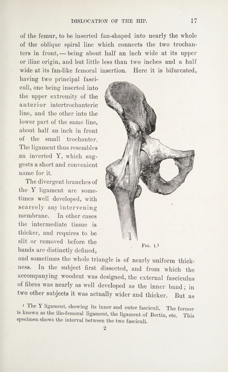 of the femur, to be inserted fan-shaped into nearly the whole of the oblique spiral line which connects the two trochan¬ ters in front, — being about half an inch wide at its upper or iliac origin, and but little less than two inches and a half wide at its fan-like femoral insertion. Here it is bifurcated, having two principal fasci¬ culi, one being inserted into the upper extremity of the anterior intertrochanteric line, and the other into the lower part of the same line, about half an inch in front of the small trochanter. The ligament thus resembles an inverted Y, which sug¬ gests a short and convenient name for it. The divergent branches of the Y ligament are some¬ times well developed, with scarcely any intervening membrane. In other cases the intermediate tissue is thicker, and requires to be slit or removed before the bands are distinctly defined, and sometimes the whole triangle is of nearly uniform thick¬ ness. In the subject first dissected, and from which the accompanying woodcut was designed, the external fasciculus of fibres was nearly as well developed as the inner band ; in two other subjects it was actually wider and thicker. But as 1 The Y ligament, showing its inner and outer fasciculi. The former is known as the ilio-femoral ligament, the ligament of Bertin, etc. This specimen shows the interval between the two fasciculi. 2 Fig. id