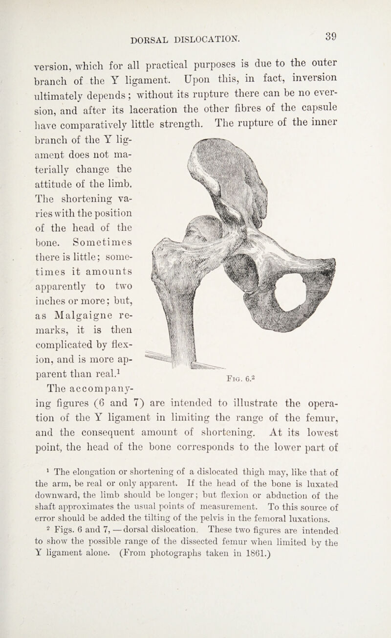 version, which for all practical purposes is due to the outer branch of the Y ligament. Upon this, in fact, inversion ultimately depends; without its rupture there can be no ever¬ sion, and after its laceration the other fibres of the capsule have comparatively little strength. The rupture of the inner branch of the Y lig¬ ament does not ma¬ terially change the attitude of the limb. The shortening va¬ ries with the position of the head of the bone. Sometimes there is little; some¬ times it amounts apparently to two inches or more; but, as Malgaigne re¬ marks, it is then complicated by flex¬ ion, and is more ap¬ parent than real.1 2 The accompany¬ ing figures (6 and 7) are intended to illustrate the opera¬ tion of the Y ligament in limiting the range of the femur, and the consequent amount of shortening. At its lowest point, the head of the bone corresponds to the lower part of 1 The elongation or shortening of a dislocated thigh may, like that of the arm, be real or only apparent. If the head of the bone is luxated downward, the limb should be longer; but flexion or abduction of the shaft approximates the usual points of measurement. To this source of error should be added the tilting of the pelvis in the femoral luxations. 2 Figs. 6 and 7, —dorsal dislocation. These two figures are intended to show the possible range of the dissected femur when limited by the Y ligament alone. (From photographs taken in 1861.)