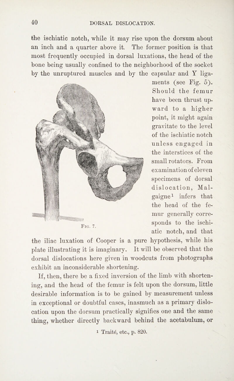 the ischiatic notch, while it may rise upon the dorsum about an inch and a quarter above it. The former position is that most frequently occupied in dorsal luxations, the head of the bone being usually confined to the neighborhood of the socket by the unruptured muscles and by the capsular and Y liga¬ ments (see Fig. 5). Should the femur have been thrust up¬ ward to a higher point, it might again gravitate to the level of the ischiatic notch unless engaged in the interstices of the small rotators. From examination of eleven specimens of dorsal dislocation, Mal- gaigne1 infers that the head of the fe¬ mur generally corre¬ sponds to the ischi¬ atic notch, and that Fig. 7. the iliac luxation of Cooper is a pure hypothesis, while his plate illustrating it is imaginary. It will be observed that the dorsal dislocations here given in woodcuts from photographs exhibit an inconsiderable shortening. If, then, there be a fixed inversion of the limb with shorten¬ ing, and the head of the femur is felt upon the dorsum, little desirable information is to be gained by measurement unless in exceptional or doubtful cases, inasmuch as a primary dislo¬ cation upon the dorsum practically signifies one and the same thing, whether directly backward behind the acetabulum, or 1 Traite, etc., p. 820.