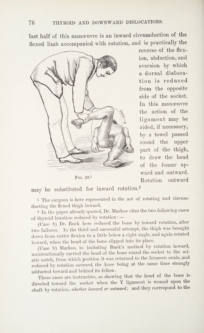 last half of this manoeuvre is an inward circumduction of the flexed limb accompanied with rotation, and is practically the reverse of the flex¬ ion, abduction, and eversion bv which d a dorsal disloca¬ tion is reduced from the opposite side of the socket. In this manoeuvre the action of the ligament may be aided, if necessary, by a towel passed round the upper part of the thigh, to draw the head of the femur up¬ ward and outward. FlG'23' Rotation outward may be substituted for inward rotation.2 1 The surgeon is here represented in the act of rotating and circum¬ ducting the flexed thigh inward. 2 In the paper already quoted, Dr. Markoe cites the two following cases of thyroid luxation reduced by rotation: (Case 8) Dr. Buck here reduced the bone by inward rotation, after two failures. In the third and successful attempt, the thigh was brought down from entire flexion to a little below a right angle, and again rotated inward, when the head of the bone slipped into its place. (Case 9) Markoe, in imitating Buck’s method by rotation inward, unintentionally carried the head of the bone round the socket to the sci¬ atic notch, from which position it was returned to the foramen ovale, and reduced by rotation outward, the knee being at the same time stiongly adducted toward and behind its fellow. These cases are instructive, as showing that the head of the bone is directed toward the socket when the Y ligament is wound upon the shaft by rotation, whether inward or outward; and they correspond to the