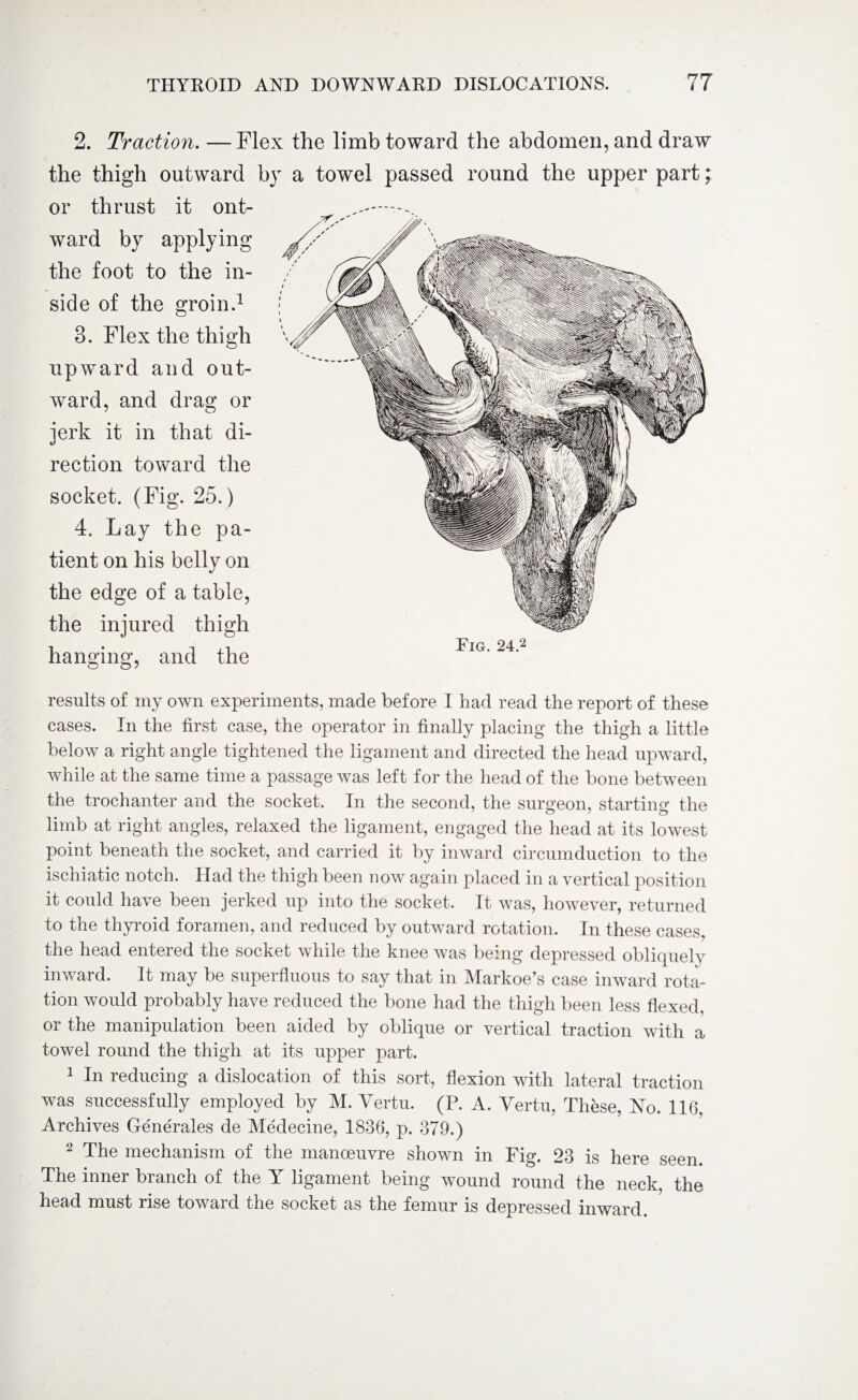 2. Traction. —Flex the limb toward the abdomen, and draw the thigh outward by a towel passed round the upper part; or thrust it ont- ward by applying the foot to the in¬ side of the groin.1 3. Flex the thigh upward and out¬ ward, and drag or jerk it in that di¬ rection toward the socket. (Fig. 25.) 4. Lay the pa¬ tient on his belly on the edge of a table, the injured thigh hanging, and the results of my own experiments, made before I had read the report of these cases. In the first case, the operator in finally placing the thigh a little below a right angle tightened the ligament and directed the head upward, while at the same time a passage was left for the head of the bone between the trochanter and the socket. In the second, the surgeon, starting the limb at right angles, relaxed the ligament, engaged the head at its lowest point beneath the socket, and carried it by inward circumduction to the ischiatic notch. Had the thigh been now again placed in a vertical position it could have been jerked up into the socket. It was, however, returned to the thyroid foramen, and reduced by outward rotation. In these cases, the head entered the socket while the knee was being depressed obliquely inward. It may be superfluous to say that in Markoe’s case inward rota¬ tion would probably have reduced the bone had the thigh been less flexed, or the manipulation been aided by oblique or vertical traction with a towel round the thigh at its upper part. 1 In reducing a dislocation of this sort, flexion with lateral traction was successfully employed by M. Vertu. (P. A. Vertu, These, No. 116, Archives Generales de Medecine, 1836, p. 379.) 2 The mechanism of the manoeuvre shown in Fig. 23 is here seen. The inner branch of the Y ligament being wound round the neck, the head must rise toward the socket as the femur is depressed inward