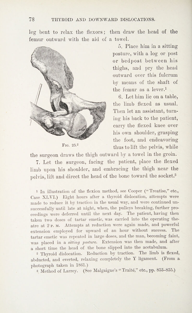 leg bent to relax the flexors; femur outward with the aid of Fig. 25.2 then draw the head of the a towel. 5. Place him in a sitting posture, writh a log or post or bedpost between his thighs, and pry the head outward over this fulcrum by means of the shaft of the femur as a lever.1 2 6. Let him lie on a table, the limb flexed as usual. Then let an assistant, turn¬ ing his back to the patient, carry the flexed knee over his own shoulder, grasping the foot, and endeavoring thus to lift the pelvis, while the surgeon draws the thigh outward by a towel in the groin. 7. Let the surgeon, facing the patient, place the flexed limb upon his shoulder, and embracing the thigh near the pelvis, lift and direct the head of the bone toward the socket.3 1 In illustration of the flexion method, see Cooper (“ Treatise,” etc., Case XLVI.) Eight hours after a thyroid dislocation, attempts were made to reduce it by traction in the usual way, and were continued un¬ successfully until late at night, when, the pulleys breaking, further pro¬ ceedings were deferred until the next day. The patient, having then taken two doses of tartar emetic, was carried into the operating the¬ atre at 2 p. m. Attempts at reduction were again made, and powerful extension employed for upward oi an hour without success. The tartar emetic was repeated in large doses, and the man, becoming faint, was placed in a sitting posture. Extension was then made, and after a short time the head of the bone slipped into the acetabulum. 2 Thyroid dislocation. Reduction by traction. The limb is flexed, abducted, and everted, relaxing completely the Y ligament. (From a photograph taken in 1861.) 3 Method of Larrey. (See Malgaigne’s “ Traite,” etc., pp. 853-855.)