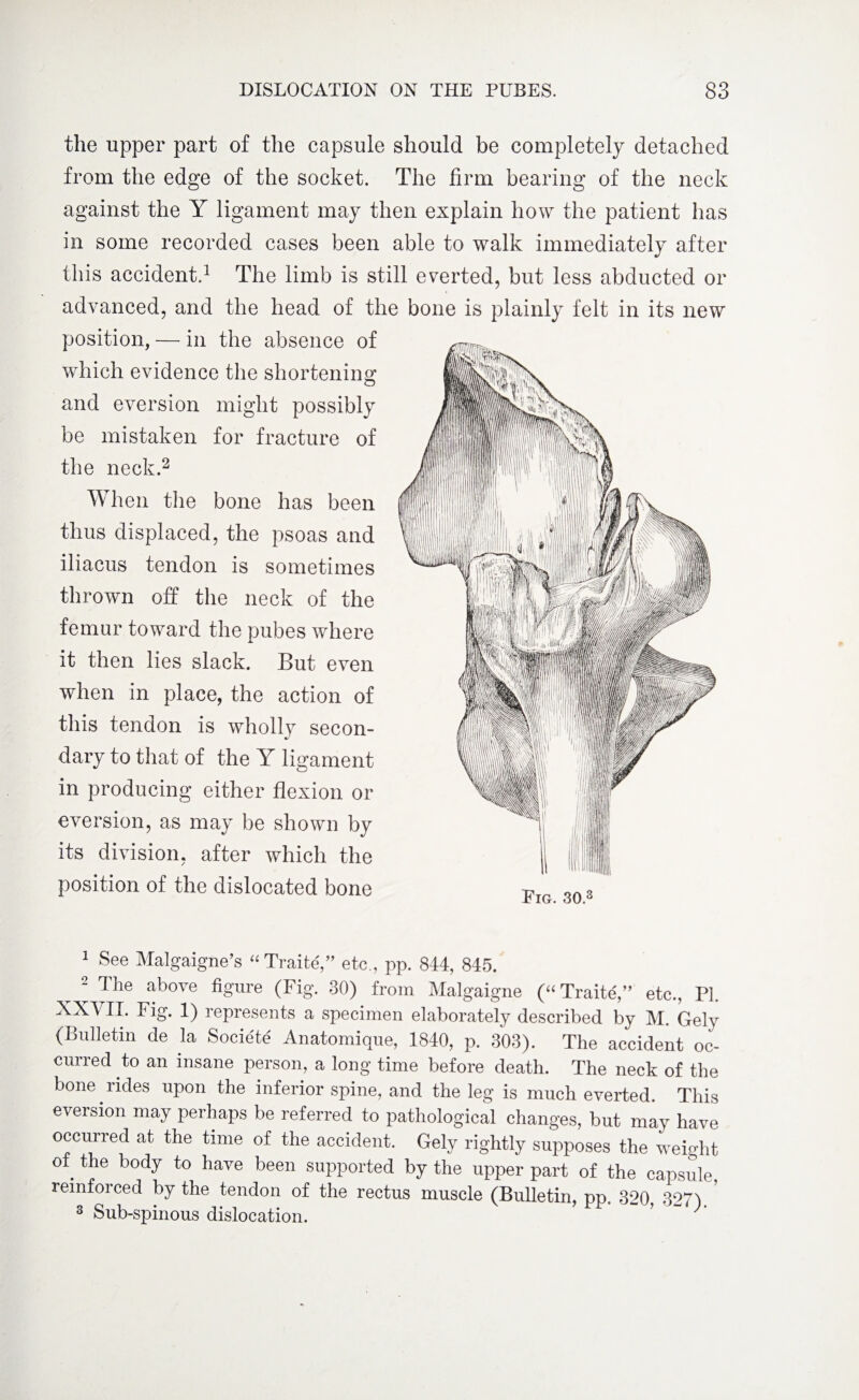 the upper part of the capsule should be completely detached from the edge of the socket. The firm bearing of the neck against the Y ligament may then explain how the patient has in some recorded cases been able to walk immediately after this accident.1 The limb is still everted, but less abducted or advanced, and the head of the bone is plainly felt in its new position, — in the absence of which evidence the shortening and eversion might possibly be mistaken for fracture of the neck.2 * * * * * 8 When the bone has been thus displaced, the psoas and iliacus tendon is sometimes thrown off the neck of the femur toward the pubes where X it then lies slack. But even when in place, the action of this tendon is wholly secon¬ dary to that of the Y ligament in producing either flexion or eversion, as may be shown by its division, after which the position of the dislocated bone Pig. 30.3 1 See Malgaigne’s “ Traite',” etc,, pp. 844, 845. „ 2 The above figure (Fig. 30) from Malgaigne (“ Traite',” etc., PI. XXVII. Fig. 1) represents a specimen elaborately described by M. Gely (Bulletin de la Societe' Anatomique, 1840, p. 303). The accident oc¬ curred to an insane person, a long time before death. The neck of the bone rides upon the inferior spine, and the leg is much everted. This eversion may perhaps be referred to pathological changes, but may have occurred at the time of the accident. Gely rightly supposes the weight of the body to have been supported by the upper part of the capsule, reinfoi ced by the tendon of the rectus muscle (Bulletin, pp. 320, 327) 8 Sub-spinous dislocation. ’ '