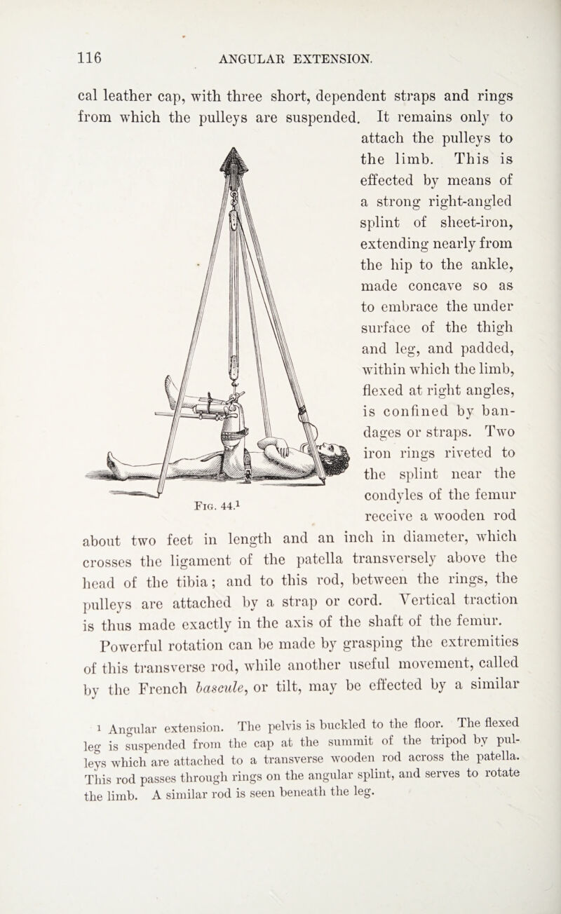 cal leather cap, with three short, dependent straps and rings from which the pulleys are suspended. It remains only to attach the pulleys to the limb. This is effected by means of a strong right-angled splint of sheet-iron, extending nearly from the hip to the ankle, made concave so as to embrace the under surface of the thigh and leg, and padded, within which the limb, flexed at right angles, is confined by ban¬ dages or straps. Two iron rings riveted to the splint near the condyles of the femur Fig. 44! receive a wooden rod about two feet in length and an inch in diameter, which crosses the ligament of the patella transversely above the head of the tibia; and to this rod, between the rings, the pulleys are attached by a strap or cord. Vertical traction is thus made exactly in the axis of the shaft of the femui. Powerful rotation can be made by grasping the extremities of this transverse rod, while another useful movement, called by the French bascule^ or tilt, may be effected by a similai 1 Angular extension. The pelvis is buckled to the flooi. The flexed leg is suspended from the cap at the summit of the tripod by pul¬ leys which are attached to a transverse wooden rod across the patella. This rod passes through rings on the angular splint, and serves to rotate the limb. A similar rod is seen beneath the leg.