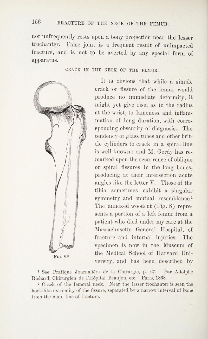 not unfrequently rests upon a bony projection near the lesser trochanter. False joint is a frequent result of unimpacted fracture, and is not to be averted by any special form of apparatus. CRACK IN THE NECK OF THE FEMUR. Fig. 8.2 It is obvious that while a simple crack or fissure of the femur would produce no immediate deformity, it might yet give rise, as in the radius at the wrist, to lameness and inflam¬ mation of long duration, with corre¬ sponding obscurity of diagnosis. The tendency of glass tubes and other brit¬ tle cylinders to crack in a spiral line is well known; and M. Gerdy has re¬ marked upon the occurrence of oblique or spiral fissures in the long bones, producing at their intersection acute angles like the letter Y. Those of the tibia sometimes exhibit a singular symmetry and mutual resemblance.1 The annexed woodcut (Fig. 8) repre¬ sents a portion of a left femur from a patient who died under my care at the Massachusetts General Hospital, of fracture and internal injuries. The specimen is now in the Museum of the Medical School of Harvard Uni¬ versity, and has been described by 1 See Pratique Journalise de la Chirurgie, p. 67. Par Adolphe Richard, Chirurgien de l’Hopital Beaujon, etc. Paris, 1868. 2 Crack of the femoral neck. Near the lesser trochanter is seen the hook-like extremity of the fissure, separated by a narrow interval of bone from the main line of fracture.