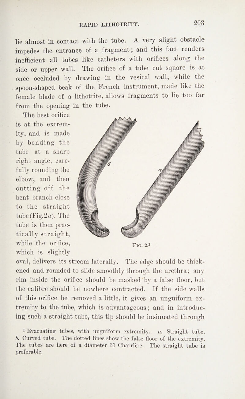 lie almost in contact with the tube. A very slight obstacle impedes the entrance of a fragment 5 and this fact renders inefficient all tubes like catheters with orifices along the side or upper wall. The orifice of a tube cut squaie is at once occluded by drawing in the vesical wall, while the spoon-shaped beak of the French instrument, made like the female blade of a lithotrite, allows fragments to lie too far from the opening in the tube. The best orifice is at the extrem¬ ity, and is made by bending the tube at a sharp right angle, care¬ fully rounding the elbow, and then cutting off the bent branch close to the straight tube (Fig.2a). The tube is then prac¬ tically straight, while the orifice, pIG 2.1 which is slightly oval, delivers its stream laterally. The edge should be thick¬ ened and rounded to slide smoothly through the urethra; any rim inside the orifice should be masked bv a false floor, but %/ ' the calibre should be nowhere contracted. If the side walls of this orifice be removed a little, it gives an unguiform ex¬ tremity to the tube, which is advantageous; and in introduc¬ ing such a straight tube, this tip should be insinuated through 1 Evacuating tubes, with unguiform extremity. a. Straight tube. b. Curved tube. The dotted lines show the false floor of the extremity. The tubes are here of a diameter 31 Charriere. The straight tube is preferable.