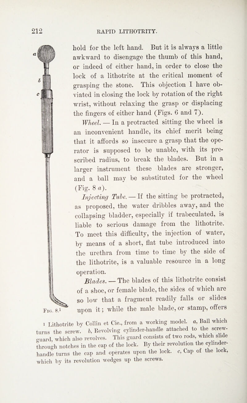Fin. 8.1 hold for the left hand. But it is always a little awkward to disengage the thumb of this hand, or indeed of either hand, in order to close the lock of a lithotrite at the critical moment of grasping the stone. This objection I have ob¬ viated in closing the lock by rotation of the right wrist, without relaxing the grasp or displacing the fingers of either hand (Figs. 6 and 7). Wheel. — In a protracted sitting the wheel is an inconvenient handle, its chief merit being that it affords so insecure a grasp that the ope¬ rator is supposed to be unable, with its pre¬ scribed radius, to break the blades. But in a larger instrument these blades are stronger, and a ball may be substituted for the wheel (Fig. 8 a). Injecting Tube. — If the sitting be protracted, as proposed, the water dribbles away, and the collapsing bladder, especially if trabeculated, is liable to serious damage from the lithotrite. To meet this difficulty, the injection of water, by means of a short, flat tube introduced into the urethra from time to time by the side of the lithotrite, is a valuable resource in a long operation. Blades. — The blades of this lithotrite consist of a shoe, or female blade, the sides of which are so low that a fragment readily falls or slides upon it; while the male blade, or stamp, offers i Lithotrite by Collin et Cie., from a working model, a, Ball which turns the screw! b, Revolving cylinder-handle attached to the screw- guard, which also revolves. This guard consists of two rods, which slide through notches in the cap of the lock. By their revolution the cylinder- handle turns the cap and operates upon the lock, c, Cap of the lock, which by its revolution wedges up the screws.