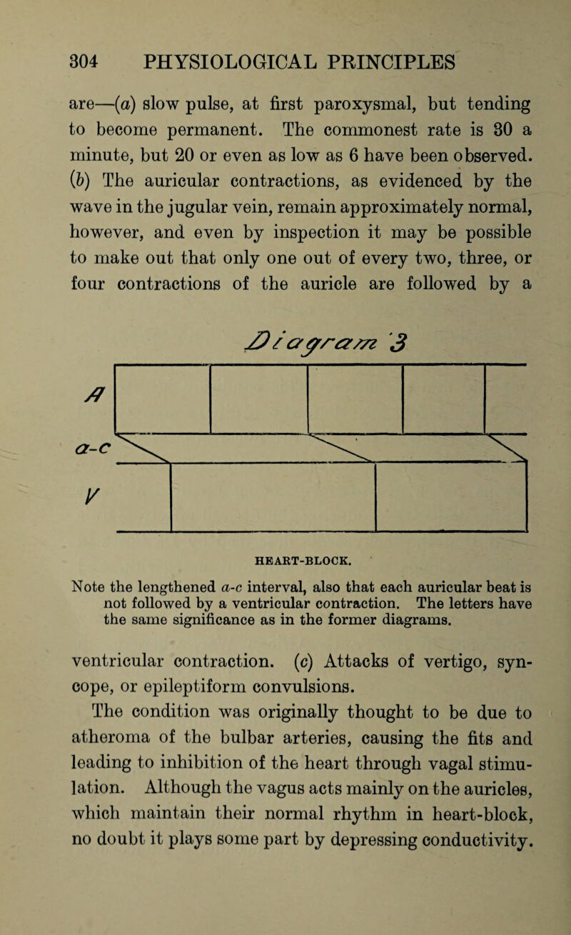 are—(a) slow pulse, at first paroxysmal, but tending to become permanent. The commonest rate is 30 a minute, but 20 or even as low as 6 have been observed. (b) The auricular contractions, as evidenced by the wave in the jugular vein, remain approximately normal, however, and even by inspection it may be possible to make out that only one out of every two, three, or four contractions of the auricle are followed by a 1 agr/~&/7i 3 HEART-BLOCK. Note the lengthened a-c interval, also that each auricular beat is not followed by a ventricular contraction. The letters have the same significance as in the former diagrams. ventricular contraction, (c) Attacks of vertigo, syn¬ cope, or epileptiform convulsions. The condition was originally thought to be due to atheroma of the bulbar arteries, causing the fits and leading to inhibition of the heart through vagal stimu¬ lation. Although the vagus acts mainly on the auricles, which maintain their normal rhythm in heart-block, no doubt it plays some part by depressing conductivity.