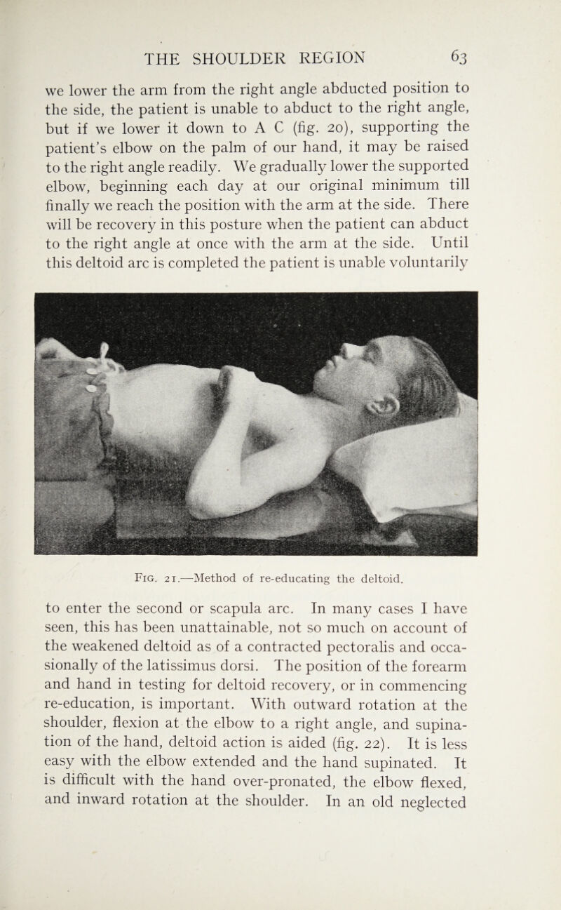 we lower the arm from the right angle abducted position to the side, the patient is unable to abduct to the right angle, but if we lower it down to A C (fig. 20), supporting the patient’s elbow on the palm of our hand, it may be raised to the right angle readily. We gradually lower the supported elbow, beginning each day at our original minimum till finally we reach the position with the arm at the side. There will be recovery in this posture when the patient can abduct to the right angle at once with the arm at the side. Until this deltoid arc is completed the patient is unable voluntarily Fig. 21.—Method of re-educating the deltoid. to enter the second or scapula arc. In many cases I have seen, this has been unattainable, not so much on account of the weakened deltoid as of a contracted pectoralis and occa¬ sionally of the latissimus dorsi. The position of the forearm and hand in testing for deltoid recovery, or in commencing re-education, is important. With outward rotation at the shoulder, flexion at the elbow to a right angle, and supina¬ tion of the hand, deltoid action is aided (fig. 22). It is less easy with the elbow extended and the hand supinated. It is difficult with the hand over-pronated, the elbow flexed, and inward rotation at the shoulder. In an old neglected