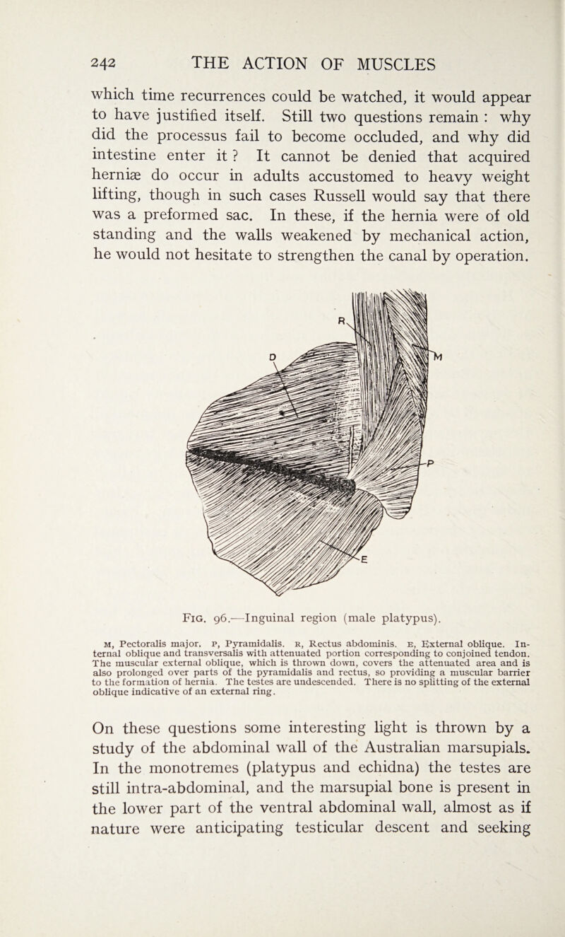 which time recurrences could be watched, it would appear to have justified itself. Still two questions remain : why did the processus fail to become occluded, and why did intestine enter it ? It cannot be denied that acquired herniae do occur in adults accustomed to heavy weight lifting, though in such cases Russell would say that there was a preformed sac. In these, if the hernia were of old standing and the walls weakened by mechanical action, he would not hesitate to strengthen the canal by operation. Fig. 96.—Inguinal region (male platypus). m, Pectoralis major, p, Pyramidalis. r, Rectus abdominis, e, External oblique. In¬ ternal oblique and transversalis with attenuated portion corresponding to conjoined tendon. The muscular external oblique, which is thrown down, covers the attenuated area and is also prolonged over parts of the pyramidalis and rectus, so providing a muscular barrier to the formation of hernia. The testes are undescended. There is no splitting of the external oblique indicative of an external ring. On these questions some interesting light is thrown by a study of the abdominal wall of the Australian marsupials. In the monotremes (platypus and echidna) the testes are still intra-abdominal, and the marsupial bone is present in the lower part of the ventral abdominal wall, almost as if nature were anticipating testicular descent and seeking