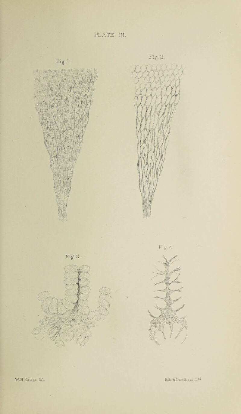 Fig-1. Fxg.2. Fxg.3. Fig. 4*. pps del . W.H.Cni Bale & Daxaelsson., l14