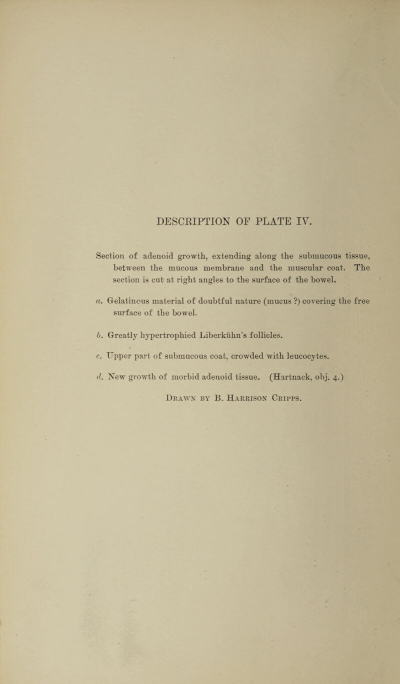 Section of adenoid growth, extending along the submucous tissue, between the mucous membrane and the muscular coat. The section is cut at right angles to the surface of the bowel. a. Gelatinous material of doubtful nature (mucus ?) covering the free surface of the bowel. />. Greatly hypertrophied Liberkiihn’s follicles. t r. Upper part of submucous coat, crowded with leucocytes. d. New growth of morbid adenoid tissue. (Hartnack, obj. 4.)