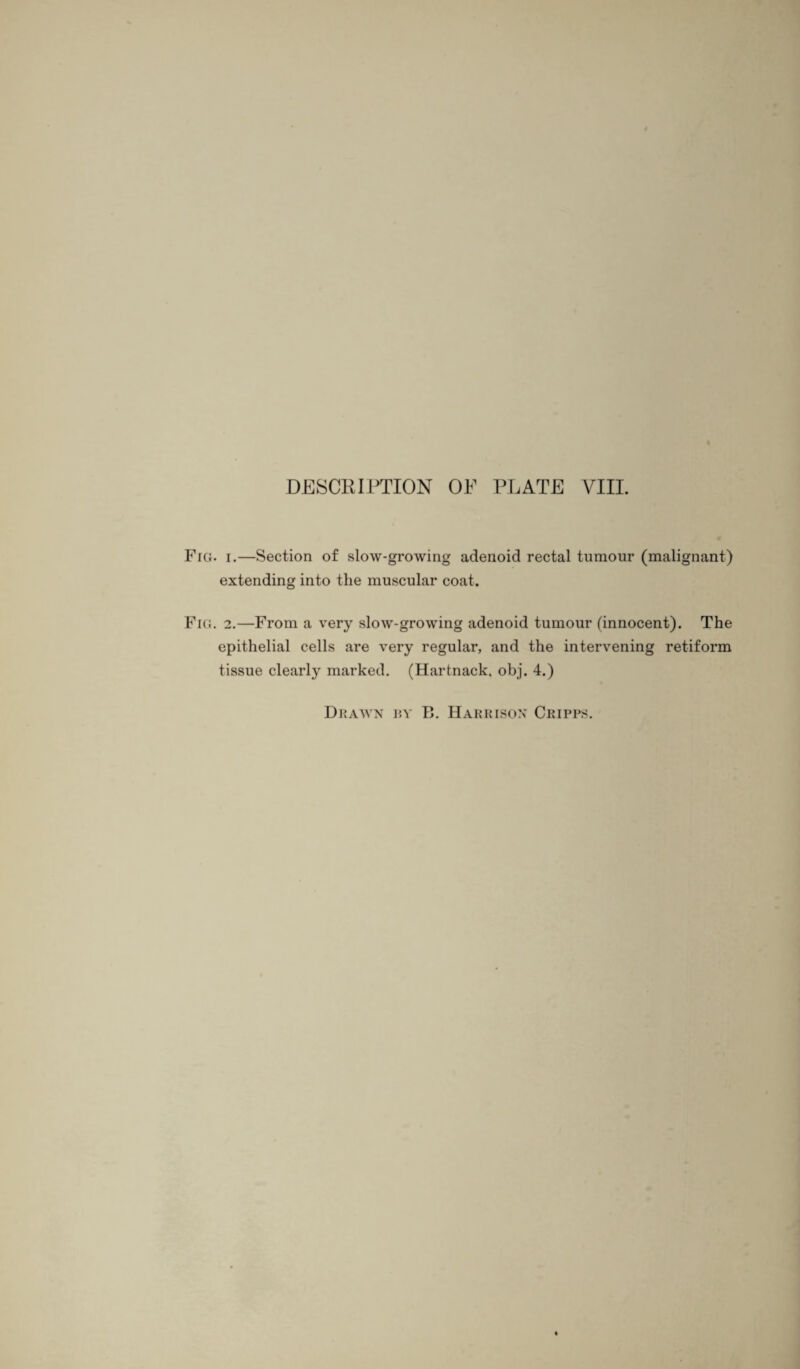 Fig. i.—Section of slow-growing adenoid rectal tumour (malignant) extending into the muscular coat. Fig. 2.—From a very slow-growing adenoid tumour (innocent). The epithelial cells are very regular, and the intervening retiform tissue clearly marked. (Hartnack, obj. 4.)