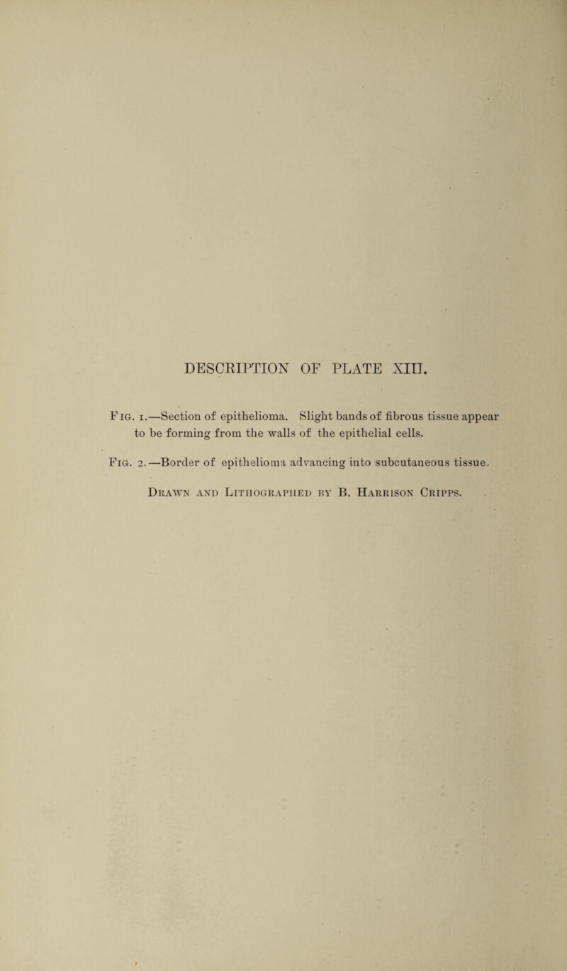 F ig. i.—Section of epithelioma. Slight bands of fibrous tissue appear to be forming from the walls of the epithelial cells. Fig. 2.—Border of epithelioma advancing into subcutaneous tissue. Drawn and Lithographed by B. Harrison Cripps.