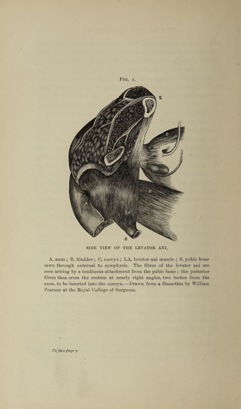 SIDE VIEW OF THE LEVATOR ANI. A, anus ; B, bladder ; C, coccyx ; LA, levator ani muscle ; S, pubic bone sawn through external to symphysis. The fibres of the levator ani are seen arising by a tendinous attachment from the pubic bone ; the posterior fibres then cross the rectum at nearly right angles, two inches from the anus, to be inserted into the coccyx.—Drawn from a dissection by William Pearson at the Royal College of Surgeons.
