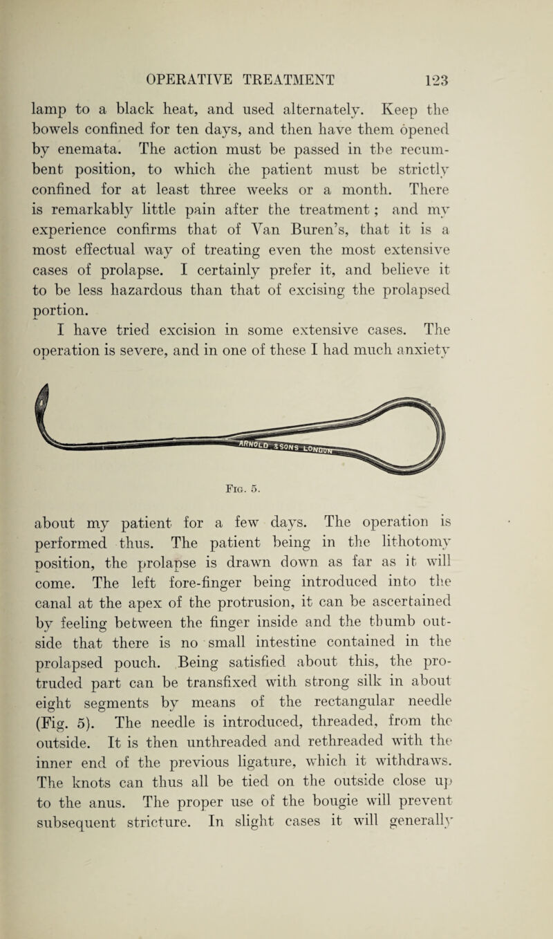 lamp to a black heat, and used alternately. Keep the bowels confined for ten days, and then have them opened by enemata. The action must be passed in the recum¬ bent position, to which the patient must be strictly confined for at least three weeks or a month. There is remarkably little pain after the treatment; and my experience confirms that of Van Buren’s, that it is a most effectual way of treating even the most extensive cases of prolapse. I certainly prefer it, and believe it to be less hazardous than that of excising the prolapsed portion. I have tried excision in some extensive cases. The operation is severe, and in one of these I had much anxiety Fig. 5. about my patient for a few days. The operation is performed thus. The patient being in the lithotomy position, the prolapse is drawn down as far as it will come. The left fore-finger being introduced into tire canal at the apex of the protrusion, it can be ascertained by feeling between the finger inside and the thumb out¬ side that there is no small intestine contained in the prolapsed pouch. Being satisfied about this, the pro¬ truded part can be transfixed with strong silk in about eight segments by means of the rectangular needle (Fig. 5). The needle is introduced, threaded, from the outside. It is then unthreaded and rethreaded with the inner end of the previous ligature, which it withdraws. The knots can thus all be tied on the outside close up to the anus. The proper use of the bougie will prevent subsequent stricture. In slight cases it will generally