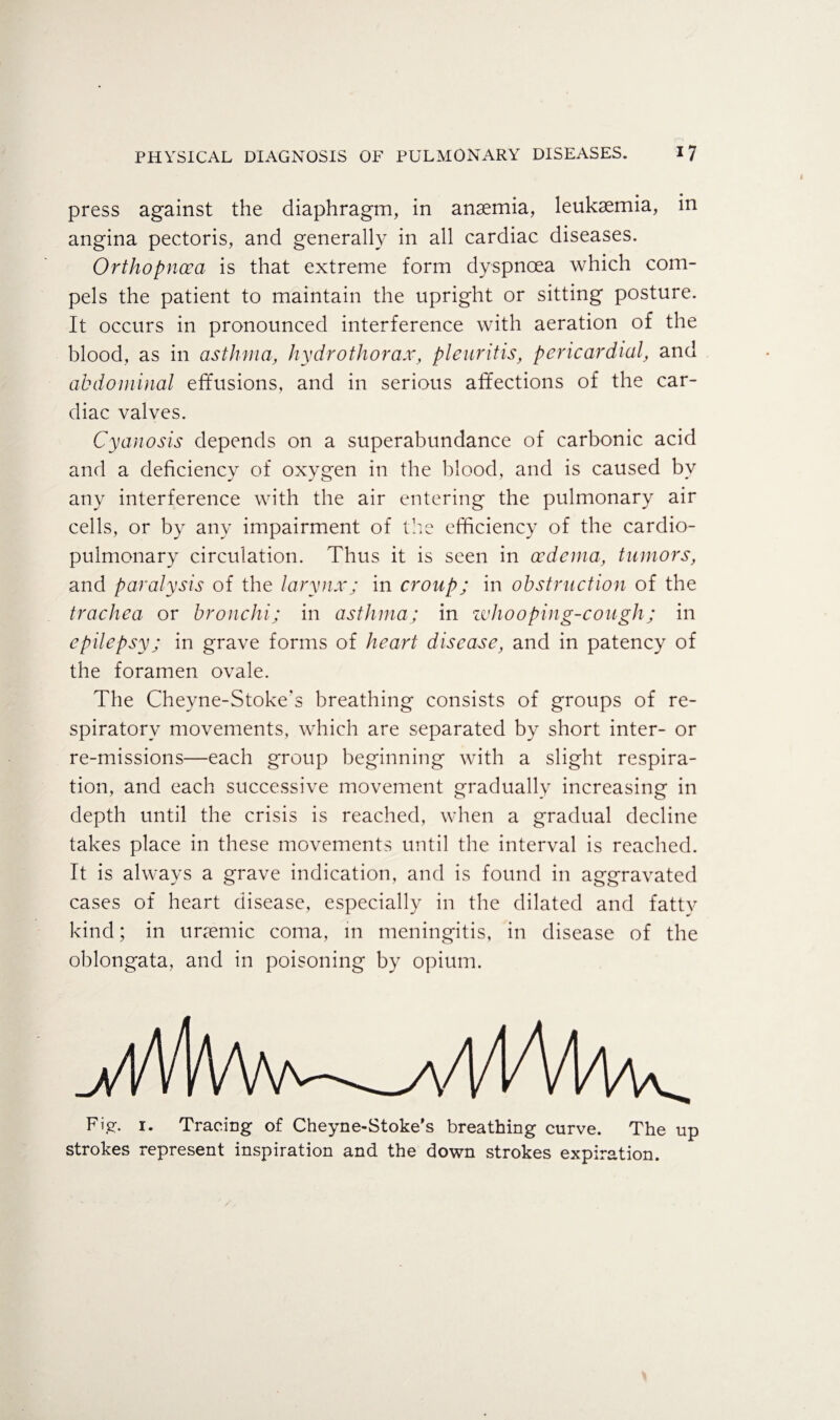 press against the diaphragm, in anaemia, leukaemia, in angina pectoris, and generally in all cardiac diseases. Ortho pnoea is that extreme form dyspnoea which com¬ pels the patient to maintain the upright or sitting posture. It occurs in pronounced interference with aeration of the blood, as in asthma, hydro thorax, pie ur it is, pericardial, and abdominal effusions, and in serious affections of the car¬ diac valves. Cyanosis depends on a superabundance of carbonic acid and a deficiency of oxygen in the blood, and is caused by any interference with the air entering the pulmonary air cells, or by any impairment of the efficiency of the cardio¬ pulmonary circulation. Thus it is seen in oedema, tumors, and paralysis of the larynx; in croup; in obstruction of the trachea or bronchi; in asthma; in zvhoo ping-cough; in epilepsy; in grave forms of heart disease, and in patency of the foramen ovale. The Cheyne-Stoke's breathing consists of groups of re¬ spiratory movements, which are separated by short inter- or re-missions—each group beginning with a slight respira¬ tion, and each successive movement gradually increasing in depth until the crisis is reached, when a gradual decline takes place in these movements until the interval is reached. It is always a grave indication, and is found in aggravated cases of heart disease, especially in the dilated and fatty kind; in uriemic coma, in meningitis, in disease of the oblongata, and in poisoning by opium. Fig. 1. Tracing of Cheyne-Stoke's breathing curve. The up strokes represent inspiration and the down strokes expiration.