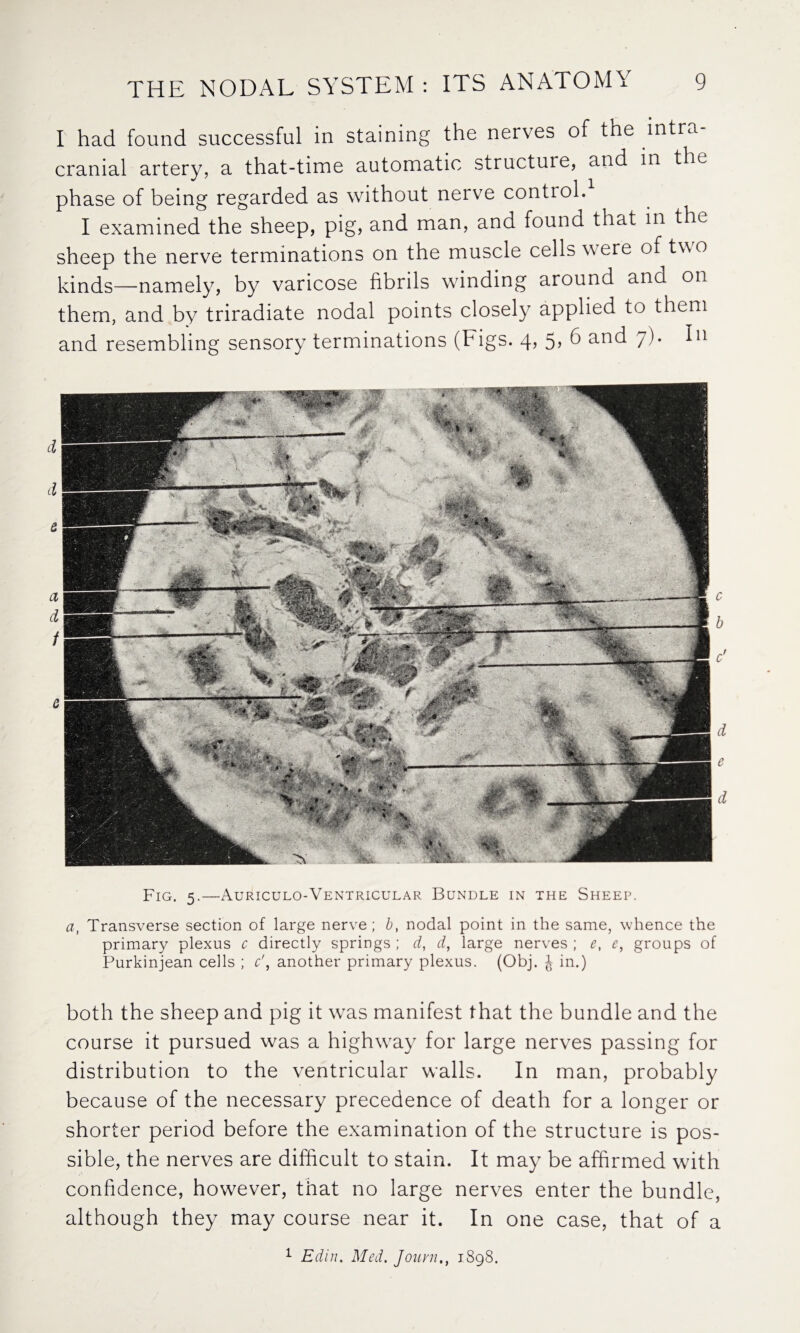 I had found successful in staining the nerves of the intra¬ cranial artery, a that-time automatic structure, and in the phase of being regarded as without nerve control. I examined the sheep, pig, and man, and found that in the sheep the nerve terminations on the muscle cells were of two kinds—namely, by varicose fibrils wdnding around and on them, and by triradiate nodal points closely applied to them and resembling sensory terminations (Figs. 4, 5, 6 and 7). In Fig. 5.—Auriculo-Ventricular Bundle in the Sheep. a, Transverse section of large nerve; b, nodal point in the same, whence the primary plexus c directly springs ; d, d, large nerves ; e, e, groups of Purkinjean cells ; c\ another primary plexus. (Obj. J in.) both the sheep and pig it was manifest that the bundle and the course it pursued was a highway for large nerves passing for distribution to the ventricular walls. In man, probably because of the necessary precedence of death for a longer or shorter period before the examination of the structure is pos¬ sible, the nerves are difficult to stain. It may be affirmed with confidence, however, that no large nerves enter the bundle, although they may course near it. In one case, that of a 1 Edin. Med. Jouvn., 1898.