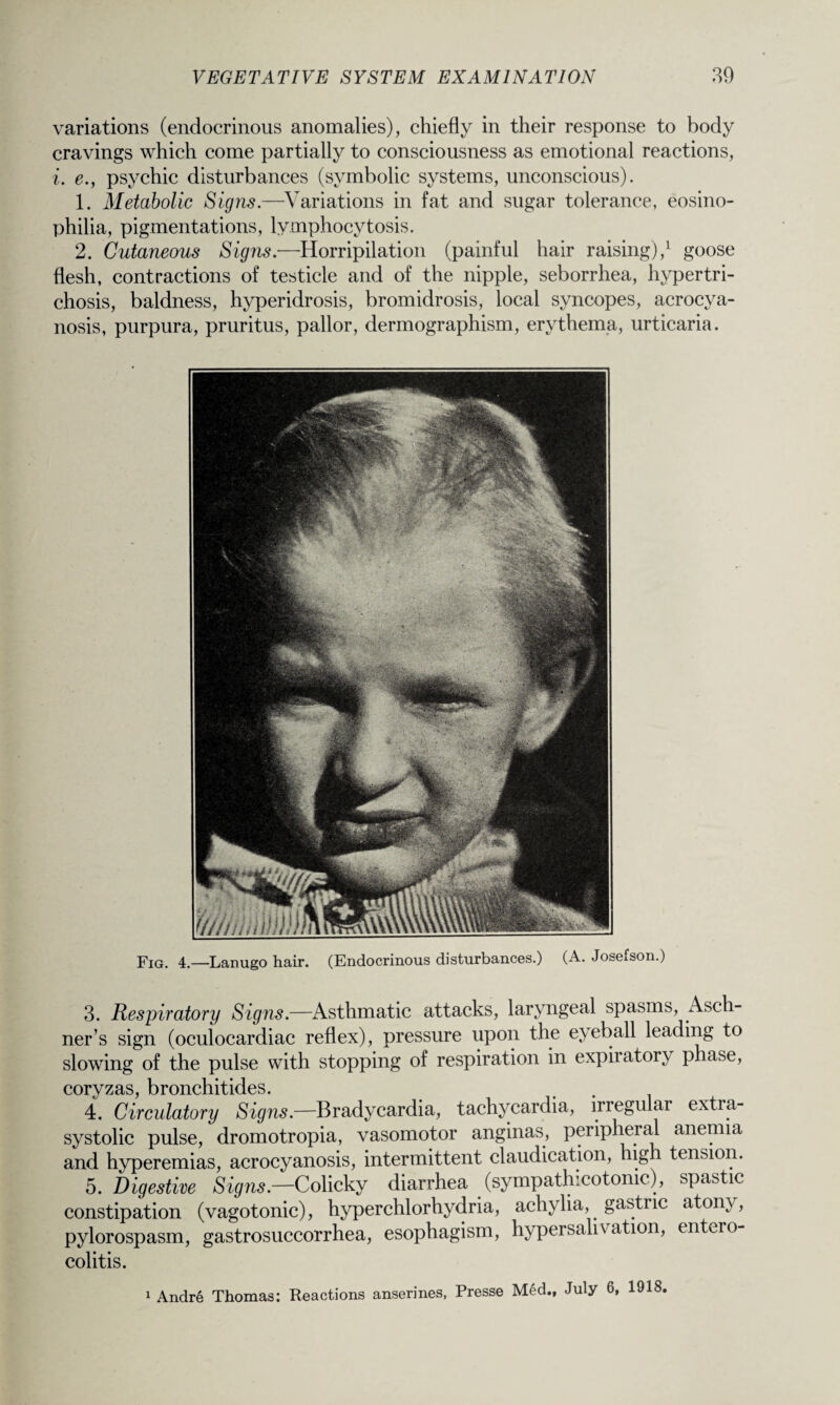 variations (endocrinous anomalies), chiefly in their response to body cravings which come partially to consciousness as emotional reactions, i. e., psychic disturbances (symbolic systems, unconscious). 1. Metabolic Signs.—Variations in fat and sugar tolerance, eosino- philia, pigmentations, lymphocytosis. 2. Cutaneous Signs.—Horripilation (painful hair raising),1 goose flesh, contractions of testicle and of the nipple, seborrhea, hypertri¬ chosis, baldness, hyperidrosis, bromidrosis, local syncopes, acrocya¬ nosis, purpura, pruritus, pallor, dermographism, erythema, urticaria. Fig. 4.—Lanugo hair. (Endocrinous disturbances.) (A. Josefson.) 3. Respiratory Signs.—Asthmatic attacks, laryngeal spasms, Asch¬ ner’s sign (oculocardiac reflex), pressure upon the eyeball leading to slowing of the pulse with stopping of respiration in expiratory phase, coryzas, bronchitides. 4. Circulatory Signs.—Bradycardia, tachycardia, irregular extra- systolic pulse, dromotropia, vasomotor anginas, peripheral anemia and hyperemias, acrocyanosis, intermittent claudication, high tension. 5. Digestive Signs.—Colicky diarrhea (sympathicotonic), spastic constipation (vagotonic), hyperchlorhydria, achylia, gastric atony, pylorospasm, gastrosuccorrhea, esophagism, hypersahvation, entero¬ colitis. 1 Andre Thomas: Reactions anserines, Presse Med., July 6, 1918,