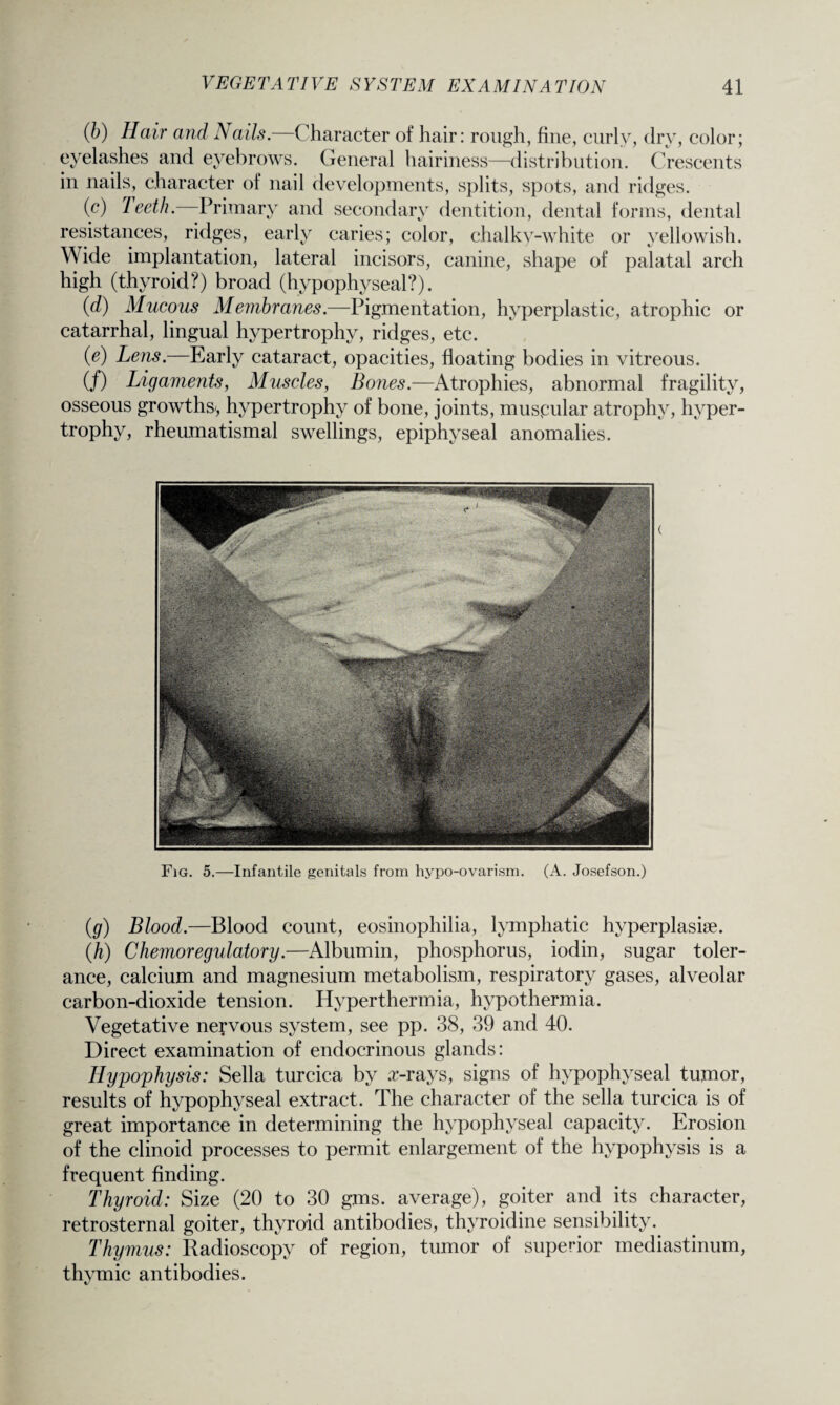 (b) Hair and Nails.—Character of hair: rough, fine, curly, dry, color; eyelashes and eyebrows. General hairiness—distribution. Crescents in nails, character of nail developments, splits, spots, and ridges. (c) Teeth. Primary and secondary dentition, dental forms, dental resistances, ridges, early caries; color, chalky-white or yellowish. Wide implantation, lateral incisors, canine, shape of palatal arch high (thyroid?) broad (hypophyseal?). (d) Mucous Membranes.—Pigmentation, hyperplastic, atrophic or catarrhal, lingual hypertrophy, ridges, etc. (e) Lens.—Early cataract, opacities, floating bodies in vitreous. (/) Ligaments, Muscles, Bones.—Atrophies, abnormal fragility, osseous growths, hypertrophy of bone, joints, muscular atrophy, hyper¬ trophy, rheumatismal swellings, epiphyseal anomalies. Fig. 5.—Infantile genitals from hypo-ovarism. (A. Josefson.) (g) Blood.—Blood count, eosinophilia, lymphatic hyperplasise. (h) Chemoregulatory.—Albumin, phosphorus, iodin, sugar toler¬ ance, calcium and magnesium metabolism, respiratory gases, alveolar carbon-dioxide tension. Hyperthermia, hypothermia. Vegetative nervous system, see pp. 38, 39 and 40. Direct examination of endocrinous glands: Hypophysis: Sella turcica by arrays, signs of hypophyseal tumor, results of hypophyseal extract. The character of the sella turcica is of great importance in determining the hypophyseal capacity. Erosion of the clinoid processes to permit enlargement of the hypophysis is a frequent finding. Thyroid: Size (20 to 30 gms. average), goiter and its character, retrosternal goiter, thyroid antibodies, thyroidine sensibility. Thymus: Radioscopy of region, tumor of superior mediastinum, thymic antibodies.