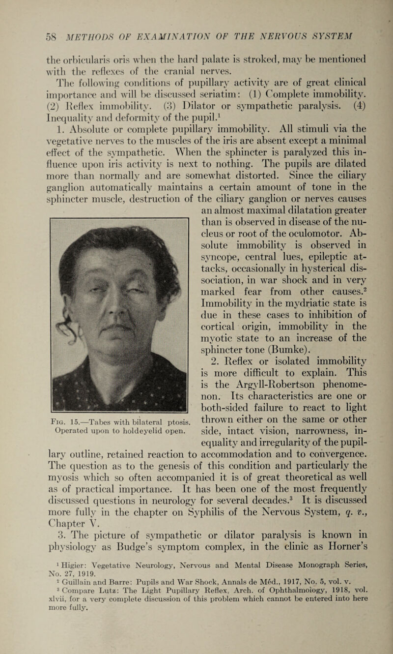the orbicularis oris when the hard palate is stroked, may be mentioned with the reflexes of the cranial nerves. The following conditions of pupillary activity are of great clinical importance and will be discussed seriatim: (1) Complete immobility. (2) Reflex immobility. (3) Dilator or sympathetic paralysis. (4) Inequality and deformity of the pupil.1 1. Absolute or complete pupillary immobility. All stimuli via the vegetative nerves to the muscles of the iris are absent except a minimal effect of the sympathetic. When the sphincter is paralyzed this in¬ fluence upon iris activity is next to nothing. The pupils are dilated more than normally and are somewhat distorted. Since the ciliary ganglion automatically maintains a certain amount of tone in the sphincter muscle, destruction of the ciliary ganglion or nerves causes an almost maximal dilatation greater than is observed in disease of the nu¬ cleus or root of the oculomotor. Ab¬ solute immobility is observed in syncope, central lues, epileptic at¬ tacks, occasionally in hysterical dis¬ sociation, in war shock and in very marked fear from other causes.2 Immobility in the mydriatic state is due in these cases to inhibition of cortical origin, immobility in the mvotic state to an increase of the sphincter tone (Bumke). 2. Reflex or isolated immobility is more difficult to explain. This is the Argyll-Robertson phenome¬ non. Its characteristics are one or both-sided failure to react to light thrown either on the same or other side, intact vision, narrowness, in¬ equality and irregularity of the pupil¬ lary outline, retained reaction to accommodation and to convergence. The question as to the genesis of this condition and particularly the myosis which so often accompanied it is of great theoretical as well as of practical importance. It has been one of the most frequently discussed questions in neurology for several decades.3 It is discussed more fully in the chapter on Syphilis of the Nervous System, q. v., Chapter V. 3. The picture of sympathetic or dilator paralysis is known in physiology as Budge’s symptom complex, in the clinic as Horner’s Fig. 15.—Tabes with bilateral ptosis. Operated upon to hold eyelid open. 1 Higier: Vegetative Neurology, Nervous and Mental Disease Monograph Series, No. 27, 1919. 2 Guillain and Barre: Pupils and War Shock, Annals de Med., 1917, No. 5, vol. v. 3 Compare Lutz: The Light Pupillary Reflex, Arch, of Ophthalmology, 1918, vol. xlvii, for a very complete discussion of this problem which cannot be entered into here more fully.