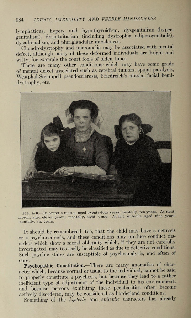lymphaticus, hyper- and hypothyroidism, dysgenitalism (hyper- genitalism), dyspituitarism (including dystrophia adiposogenital is), dvsadrenalism, and pluriglandular imbalances. Chondrodystrophy and micromelia may be associated with mental defect, although many of these deformed individuals are bright and witty, for example the court fools of olden times. There are many other conditions* which may have some grade of mental defect associated such as cerebral tumors, spinal paralysis, Westphal-Strumpell pseudosclerosis, Friedreich’s ataxia,- facial hemi- dvstrophy, etc. Fig. 470.—In center a moron, aged twenty-four years; mentally, ten years. At right, moron, aged eleven years; mentally, eight years. At left, imbecile, aged nine years, mentally, six years. It should be remembered, too, that the child may have a neurosis or a psychoneurosis, and these conditions may produce conduct dis¬ orders which show a moral obliquity which, if they are not carefully investigated, may too easily be classified as due to defective conditions. Such psychic states are susceptible of psychoanalysis, and often of cure. Psychopathic Constitution.—There are many anomalies of char¬ acter which, because normal or usual to the individual, cannot be said to properly constitute a psychosis, but because they lead to a rat he i inefficient type of adjustment of the individual to his environment, and because persons exhibiting these peculiarities often become actively disordered, may be considered as borderland conditions. Something of the hysteric and epileptic characters has already