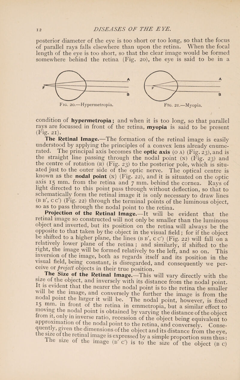 posterior diameter of the eye is too short or too long, so that the focus of parallel rays falls elsewhere than upon the retina. When the focal length of the eye is too short, so that the clear image would be formed somewhere behind the retina (Fig. 20), the eye is said to be in a condition of hypermetropia; and when it is too long, so that parallel rays are focussed in front of the retina, myopia is said to be present (Fig. 21). The Retinal Image.—The formation of the retinal image is easily understood by applying the principles of a convex lens already enume¬ rated. The principal axis becomes the optic axis (o A) (Fig. 23), and is the straight line passing through the nodal point (n) (Fig. 23) and the centre of rotation (r) (Fig. 23) to the posterior pole, which is situ¬ ated just to the outer side of the optic nerve. The optical centre is known as the nodal point (n) (Fig. 22), and it is situated on the optic a.xis 15 mm. from the retina and 7 mm. behind the cornea. Rays of light directed to this point pass through without deflection, so that to schematically form the retinal image it is only necessary to draw lines (b b , cc) (Fig. 22) through the terminal points of the luminous object, so as to pass through the nodal point to the retina. Projection of the Retinal Image.--—It will be evident that the retinal image so constructed will not only be smaller than the luminous object and inverted, but its position on the retina will always be the opposite to that taken by the object in the visual field; for if the object be shifted to a higher plane, the lines (b b', c c') (Fig. 22) will fall on a relatively lower plane of the retina ; and similarly, if shifted to the right, the image will be formed relatively to the left, and so on. This inversion of the image, both as regards itself and its position in the visual field, being constant, is disregarded, and consequently we per¬ ceive or project objects in their true position. . Size of the Retinal Image.—This will vary directly with the size ot the object, and inversely with its distance from the nodal point, tt is evident that the nearer the nodal point is to the retina the smaller \wii be the image, and conversely the further the image is from the no a point the larger it will be. The nodal point, however, is fixed 15 mm. in ront of the retina in emmetropia, but a similar effect to moving the nodal point is obtained by varying the distance of the object om it, only m inverse ratio, recession of the object being equivalent to nnPntlXlmatl0nfBf ^ n°dal P°int to the retina> and conversely. Conse- the dl,mensions of the object and its distance from the eye, nr, . ae Ye image is expressed by a simple proportion sum thus: The size of the image (s' c') is to the size of the object (b c)