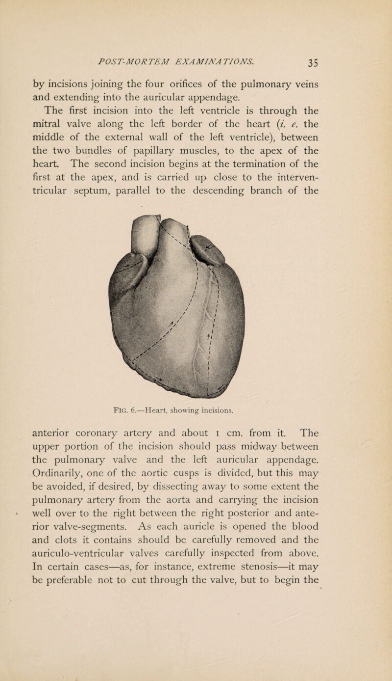 by incisions joining the four orifices of the pulmonary veins and extending into the auricular appendage. The first incision into the left ventricle is through the mitral valve along the left border of the heart (i. e. the middle of the external wall of the left ventricle), between the two bundles of papillary muscles, to the apex of the heart The second incision begins at the termination of the first at the apex, and is carried up close to the interven¬ tricular septum, parallel to the descending branch of the Fig. 6.—Heart, showing incisions. anterior coronary artery and about I cm. from it. The upper portion of the incision should pass midway between the pulmonary valve and the left auricular appendage. Ordinarily, one of the aortic cusps is divided, but this may be avoided, if desired, by dissecting away to some extent the pulmonary artery from the aorta and carrying the incision well over to the right between the right posterior and ante¬ rior valve-segments. As each auricle is opened the blood and clots it contains should be carefully removed and the auriculo-ventricular valves carefully inspected from above. In certain cases—as, for instance, extreme stenosis—it may be preferable not to cut through the valve, but to begin the