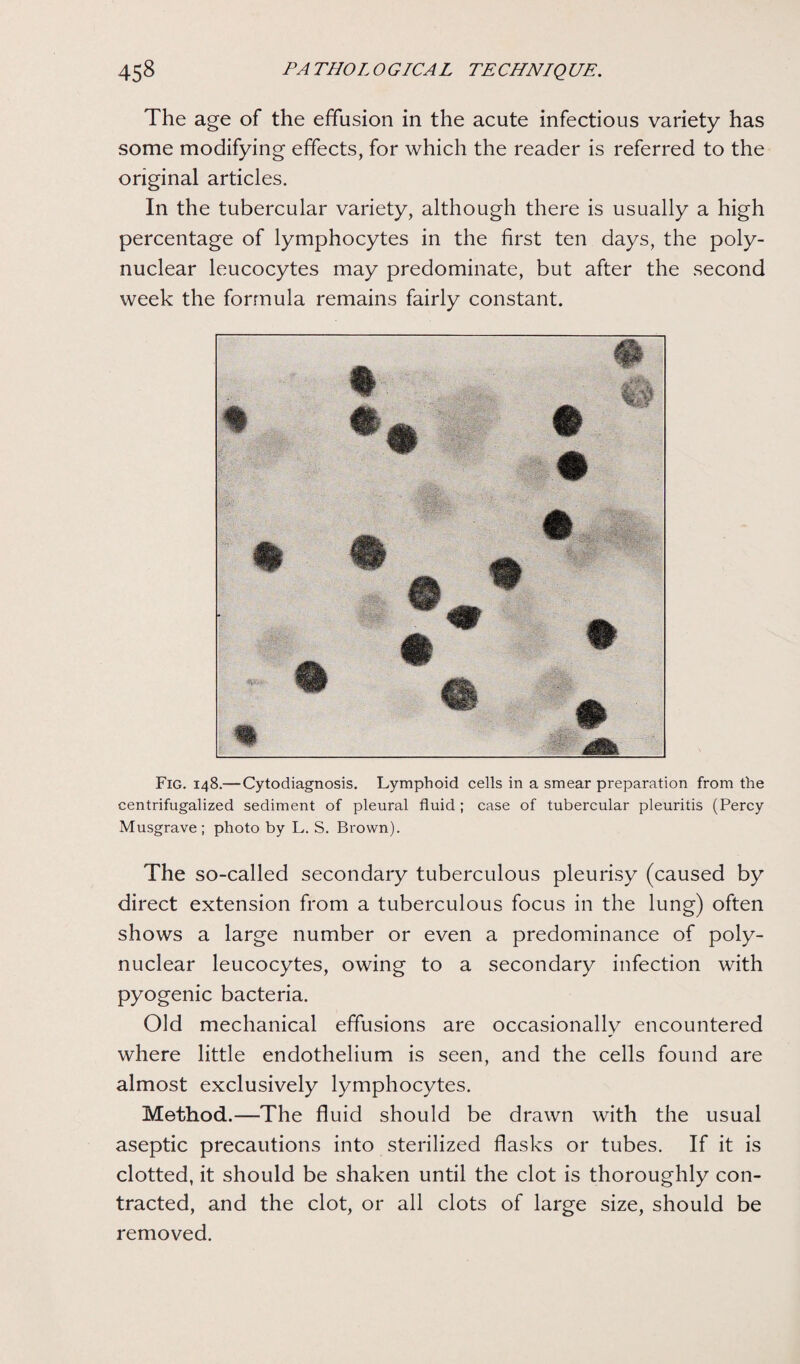 The age of the effusion in the acute infectious variety has some modifying effects, for which the reader is referred to the original articles. In the tubercular variety, although there is usually a high percentage of lymphocytes in the first ten days, the poly¬ nuclear leucocytes may predominate, but after the second week the formula remains fairly constant. Fig. 148.—Cytodiagnosis. Lymphoid cells in a smear preparation from the centrifugalized sediment of pleural fluid ; case of tubercular pleuritis (Percy Musgrave; photo by L. S. Brown). The so-called secondary tuberculous pleurisy (caused by direct extension from a tuberculous focus in the lung) often shows a large number or even a predominance of poly¬ nuclear leucocytes, owing to a secondary infection with pyogenic bacteria. Old mechanical effusions are occasionally encountered where little endothelium is seen, and the cells found are almost exclusively lymphocytes. Method.—The fluid should be drawn with the usual aseptic precautions into sterilized flasks or tubes. If it is clotted, it should be shaken until the clot is thoroughly con¬ tracted, and the clot, or all clots of large size, should be removed.
