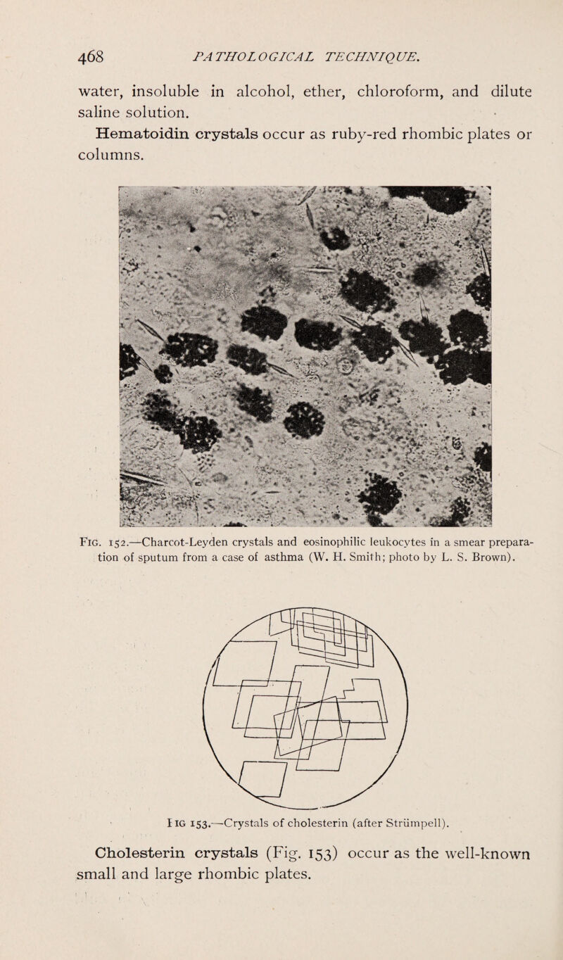 water, insoluble in alcohol, ether, chloroform, and dilute saline solution. Hematoidin crystals occur as ruby-red rhombic plates or columns. Fig. 152.—Charcot-Leyden crystals and eosinophilic leukocytes in a smear prepara¬ tion of sputum from a case of asthma (W. H. Smith; photo by L. S. Brown). IlG 153.—Crystals of cholesterin (after Striimpell). Cholesterin crystals (Fig. 153) occur as the well-known small and large rhombic plates. 1