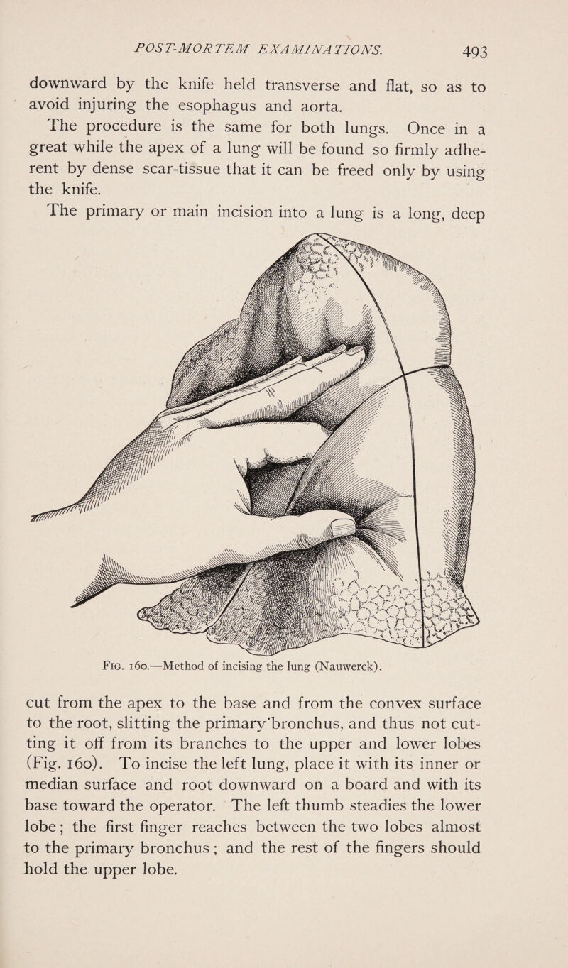 downward by the knife held transverse and flat, so as to avoid injuring the esophagus and aorta. The procedure is the same for both lungs. Once in a great while the apex of a lung will be found so firmly adhe¬ rent by dense scar-tissue that it can be freed only by using the knife. The primary or main incision into a lung is a long, deep cut from the apex to the base and from the convex surface to the root, slitting the primary'bronchus, and thus not cut¬ ting it off from its branches to the upper and lower lobes (Fig. 160). To incise the left lung, place it with its inner or median surface and root downward on a board and with its base toward the operator. The left thumb steadies the lower lobe; the first finger reaches between the two lobes almost to the primaiy bronchus; and the rest of the fingers should hold the upper lobe.