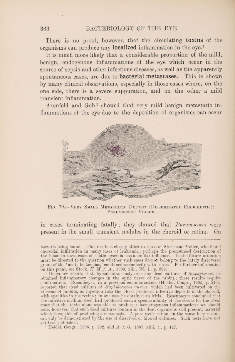 There is no proof, however, that the circulating toxins of the organisms can produce any localized inflammation in the eye.* 1 It is much more likely that a considerable proportion of the mild, benign, endogenous inflammations of the eye which occur in the course of sepsis and other infectious diseases, as well as the apparently spontaneous cases, are due to bacterial metastases. This is shown by many clinical observations, especially in those cases where, on the one side, there is a severe suppuration, and on the other a mild transient inflammation. Axenfeld and Goh2 showed that very mild benign metastatic in¬ flammations of the eye due to the deposition of organisms can occur Fig. 79.—Very Small Metastatic Deposit (Disseminated Choroiditis) : Pneumococci Violet. in cases terminating fatally; they showed that Pneumococci were present in the small transient nodules in the choroid or retina. On bacteria being found. This result is closely allied to those of Stock and Meller, who found choroidal infiltration in many cases of leukfemia; perhaps the pronounced destruction of the blood in these cases of septic pytemia has a similar influence. In the future attention must be directed to the question whether such cases do not belong to the lately discovered group of the ‘ acute leukaemias, ’ combined secondarily with sepsis. For further information on this point, see Stock. K. M. /. A., 1906, xlii., Bd. i., p. 328. 1 Dolganow reports that, by subcutaneously injecting dead cultures of Staphylococci, he obtained inflammatory changes in the optic nerve of the rabbit; these results require confirmation. Rosenmeyer, in a previous communication (Heidel. Congr., 1905, p. 240), reported that dead cultures of Staphylococcus aureus, which had been cultivated on the vitreous of rabbits, on injection into the blood produced infective deposits in the choroid, with opacities in the retina ; in one case he obtained an iritis. Rosenmeyer concluded that the nutritive medium used had produced such a specific affinity of the coccus for the uveal tract that the toxin alone was able to produce a hsematogenous inflammation ; we should note, however, that such dead cultures contain in the dead organisms still present, material which is capable of producing a metastasis. A pure toxic action, in the sense here meant, can only be demonstrated by the use of dissolved or filtered cultures. Such tests have not yet been published. 2 Heidel. Congr., 1896, p. 282, and A. f. 0., 1897, xliii., i., p. 147.