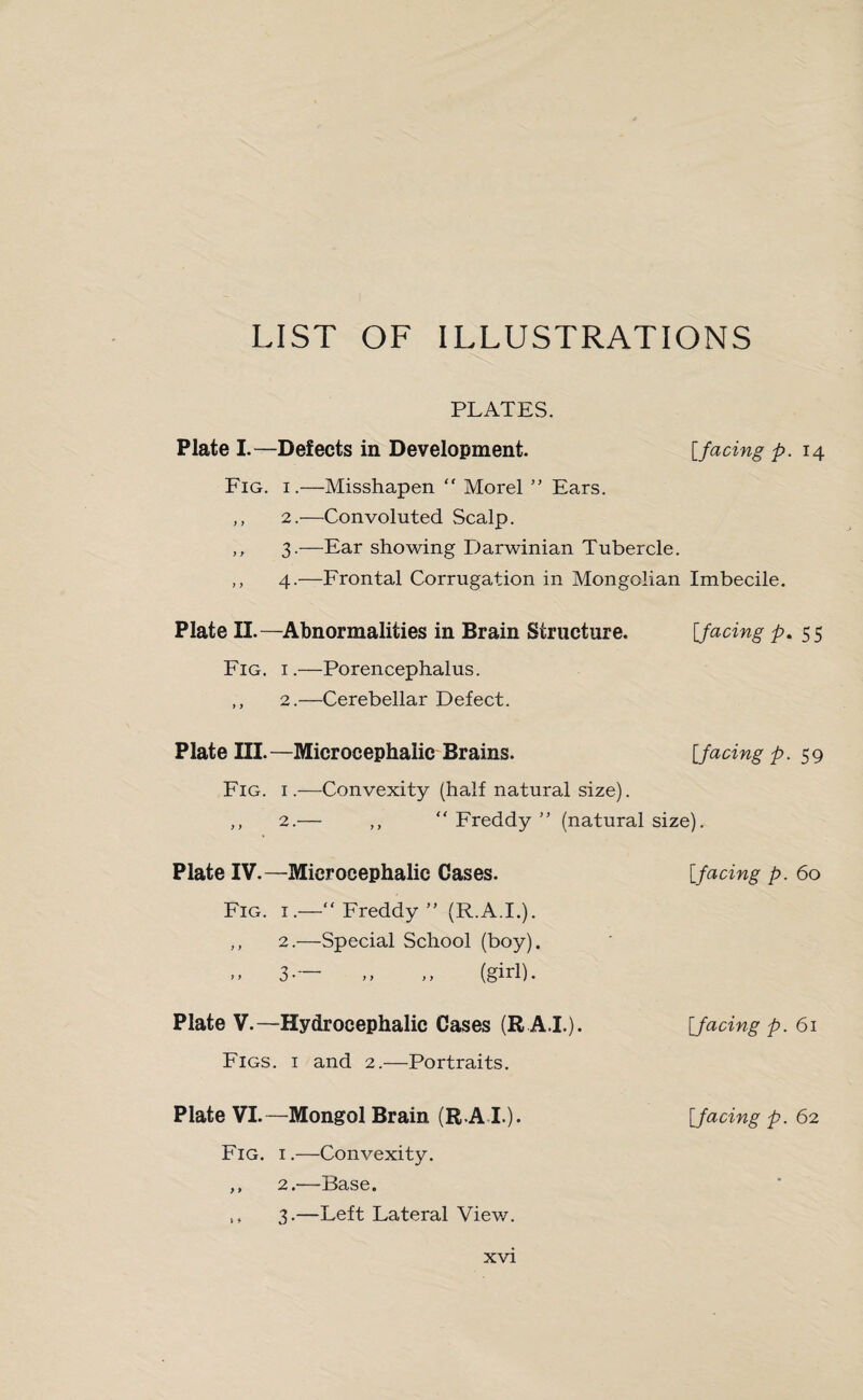 LIST OF ILLUSTRATIONS PLATES. Plate I.—Defects in Development. [facing p. 14 Fig. 1.—Misshapen “ Morel ” Ears. 2. —Convoluted Scalp. 3. —Ear showing Darwinian Tubercle. 4. —Frontal Corrugation in Mongolian Imbecile. Plate II.—Abnormalities in Brain Structure. [facing p. 55 Fig. 1.—Porencephalus. ,, 2.—Cerebellar Defect. Plate III.—Microcephaiic Brains. [facing p. 59 Fig. i.-—Convexity (half natural size). ,, 2.— ,, “Freddy” (natural size). Plate IV.—Microcephaiic Cases. [facing p. 60 Fig. i.—“Freddy” (R.A.I.). „ 2.—Special School (boy). >> 3-— „ (girl). Plate V.—Hydrocephalic Cases (R.A.I.). Figs, i and 2.—Portraits. [facing p. 61 Plate VI.—Mongol Brain (R.A I.). Fig. 1.—Convexity. ,, 2.-—Base. „ 3.—Left Lateral View. [facing p. 62