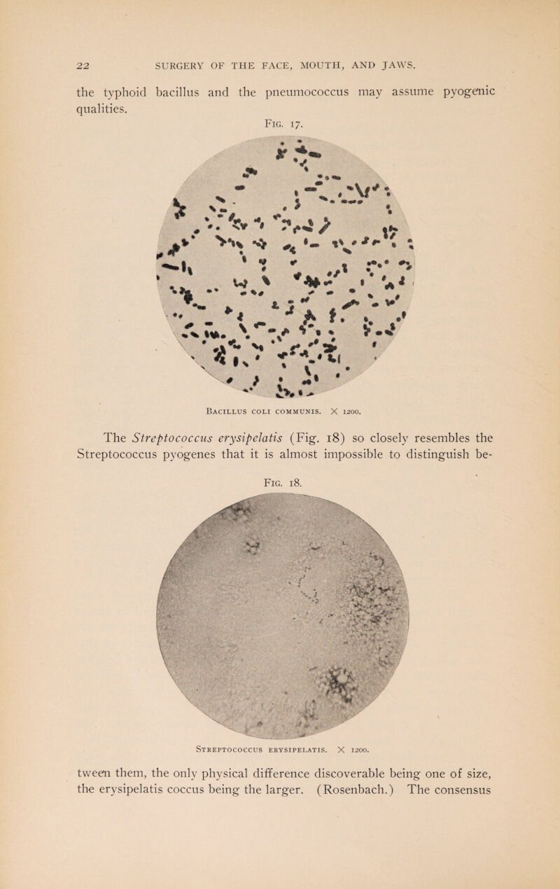 the typhoid bacillus and the pneumococcus may assume pyogenic qualities. Fig. 17. *4 • a <•» * . U\f ^ «* m<a»» ♦ • xv # 7 « t *** «*> ^ I' * **• % • ^ i f ♦/* * » «# # w % ** •*' **• A, v lift* * « t-.* *5, ^ jft & J* 1 tf «• 41 ❖ *• 1 % .# ' % # ft. <d * %*. \ * • * * *A*- V • \4»%* t .-**• M 8 # X. A ft ft % ft * X# / * #§ 1 ** £*# • ^ Bacillus coli communis. X 1200. The Streptococcus erysipclatis (Fig. 18) so closely resembles the Streptococcus pyogenes that it is almost impossible to distinguish be- Fig. 18. Streptococcus erysipelatis. X 1200. tween them, the only physical difference discoverable being one of size, the erysipelatis coccus being the larger. (Rosenbach.) The consensus