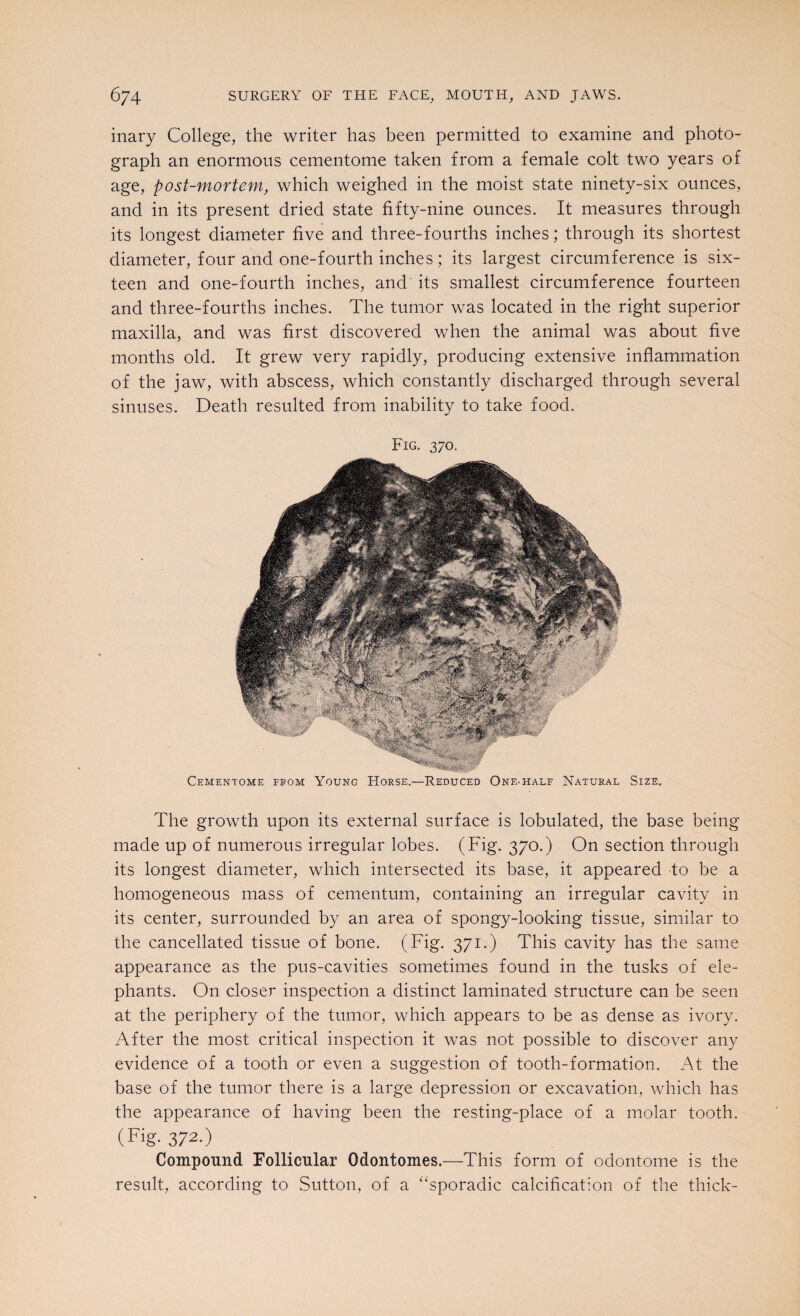 inary College, the writer has been permitted to examine and photo¬ graph an enormous cementome taken from a female colt two years of age, post-mortem, which weighed in the moist state ninety-six ounces, and in its present dried state fifty-nine ounces. It measures through its longest diameter five and three-fourths inches; through its shortest diameter, four and one-fourth inches; its largest circumference is six¬ teen and one-fourth inches, and its smallest circumference fourteen and three-fourths inches. The tumor was located in the right superior maxilla, and was first discovered when the animal was about five months old. It grew very rapidly, producing extensive inflammation of the jaw, with abscess, which constantly discharged through several sinuses. Death resulted from inability to take food. Fig. 370. Cementome from Young Horse.—Reduced One-half Natural Size. The growth upon its external surface is lobulated, the base being made up of numerous irregular lobes. (Fig. 370.) On section through its longest diameter, which intersected its base, it appeared to be a homogeneous mass of cementum, containing an irregular cavity in its center, surrounded by an area of spongy-looking tissue, similar to the cancellated tissue of bone. (Fig. 371.) This cavity has the same appearance as the pus-cavities sometimes found in the tusks of ele¬ phants. On closer inspection a distinct laminated structure can be seen at the periphery of the tumor, which appears to be as dense as ivory. After the most critical inspection it was not possible to discover any evidence of a tooth or even a suggestion of tooth-formation. At the base of the tumor there is a large depression or excavation, which has the appearance of having been the resting-place of a molar tooth. (Fig- 372-) Compound Follicular Odontomes.—This form of odontome is the result, according to Sutton, of a “sporadic calcification of the thick-