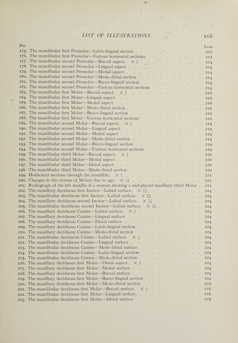 ■^IG’ Page 175. The mandibular first Premolar—Labio-lingual section . . . . •.212 176. The mandibular first Premolar—Various horizontal sections.. . . . 212 177. The mandibular second Premolar—Buccal aspect. X { . . ..214 178. The mandibular second Premolar—Lingual aspect , . .’ . . . . . . . 214 179. The mandibular second Premolar—Mesial aspect ..214 180. The mandibular second Premolar—Mesio-distal section . . ..; 214 181. The mandibular second Premolar—Bucco-lingual section . . . . . . 214 182. The mandibular second Premolar—Various horizontal sections.'. .214 183. The mandibular first Molar—Buccal aspect. X {■..216 184. The mandibular first Molar—Lingual aspect. . .216 185. The mandibular first Molar—Mesial aspect....... 216 186. The mandibular first Molar—Mesio-distal section.216 187. The mandibular first Molar—Bucco-lingual section.216 188. The mandibular first Molar—Various horizontal sections.216 189. The mandibular second Molar—Buccal aspect. X {.219 190. The mandibular second Molar—Lingual aspect.219 191. The mandibular second Molar—Mesial aspect.219 192. The mandibular second Molar—Mesio-distal section.219 193. The mandibular second Molar—Bucco-lingual section. .219 194. The mandibular second Molar—Various horizontal sections.219 195. The mandibular third Molar—Buccal aspect. X j.220 196. The mandibular third Molar—Mesial aspect.220 197. The mandibular third Molar—Distal aspect.220 198. The mandibular third Molar—Mesio-distal section.220 199. Horizontal sections through the mandible. X f.221 200. Changes in the crowns of Molars due to age. X U.221 201. Radiograph of the left maxilla of a woman showing a mal-placed maxillary third Molar . 221 202. The maxillary deciduous first Incisor—Labial surface. X ttf.224 203. The mandibular deciduous first Incisor—Labial surface. X y<j .224 204. The maxillary deciduous second Incisor—Labial surface. X }|.224 205. The mandibular deciduous second Incisor—-Labial surface. X }J-.224 206. The maxillary deciduous Canine—Labial surface. X i.224 207. The maxillary deciduous Canine—Lingual surface .224 208. The maxillary deciduous Canine—Distal surface.224 209. The maxillary deciduous Canine—Labio-lingual section.224 210. The maxillary deciduous Canine—Mesio-distal section.224 211. The mandibular deciduous Canine—Labial surface. X j-.224 212. The mandibular deciduous Canine—Lingual surface.224 213. The mandibular deciduous Canine—Mesio-labial surface.224 214. The mandibular deciduous Canine—Labio-lingual section.224 215. The mandibular deciduous Canine—Mesio-distal section. . . 224 216. The maxillary deciduous first Molar—Distal aspect. X {.224 217. The maxillary deciduous first Molar—Mesial surface.224 218. The maxillary deciduous first Molar—Buccal surface.224 219. The maxillary deciduous first Molar—Bucco-lingual section.224 220. The maxillary deciduous first Molar—Mesio-distal section.224 221. The mandibular deciduous first Molar—Buccal surface. X |. • 225 222. The mandibular deciduous first Molar—Lingual surface . 225 223. The mandibular deciduous first Molar—Distal surface.225