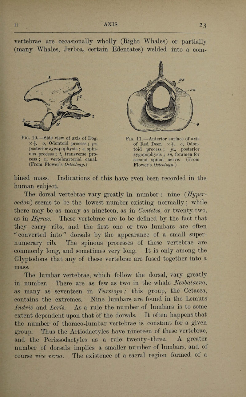 AXIS vertebrae are occasionally wholly (Eight Whales) or partially (many Whales, Jerboa, certain Edentates) welded into a com- 4 .0 Fig. 10.—Side view of axis of Dog. x f. 0, Odontoid process ; pz, posterior zygapophysis ; s, spin¬ ous process ; t, transverse pro¬ cess ; v, vertebrarterial canal. (From Flower’s Osteology.) Fig. 11.—Anterior surface of axis of Red Deer, x ■§. 0, Odon¬ toid process ; pz, posterior zygapophysis ; sn, foramen for second spinal nerve. (From Flower’s Osteology.) bined mass. Indications of this have even been recorded in the human subject. The dorsal vertebrae vary greatly in number : nine (Hyper- oodon) seems to be the lowest number existing normally ; while there may be as many as nineteen, as in Centetes, or twenty-two, as in Hyrcix. These vertebrae are to be defined by the fact that they carry ribs, and the first one or two lumbars are often “ converted into ” dorsals by the appearance of a small super¬ numerary rib. The spinous processes of these vertebrae are commonly long, and sometimes very long. It is only among the Glyptodons that any of these vertebrae are fused together into a mass. The lumbar vertebrae, which follow the dorsal, vary greatly in number. There are as few as two in the whale Neobalaena, as many as seventeen in Tursiops; this group, the Cetacea, contains the extremes. Nine lumbars are found in the Lemurs Indris and Loris. As a rule the number of lumbars is to some extent dependent upon that of the dorsals. It often happens that the number of thoraco-lumbar vertebrae is constant for a given group. Thus the Artiodactyles have nineteen of these vertebrae, and the Perissodactyles as a rule twenty-three. A greater number of dorsals implies a smaller number of lumbars, and of course vice versa. The existence of a sacral region formed of a