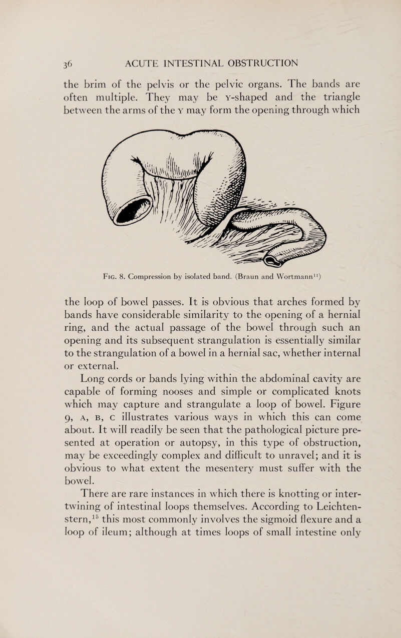 the brim of the pelvis or the pelvic organs. The bands are often multiple. They may be Y-shaped and the triangle between the arms of the y may form the opening through which Fig. 8. Compression by isolated band. (Braun and Wortmann11) the loop of bowel passes. It is obvious that arches formed by bands have considerable similarity to the opening of a hernial ring, and the actual passage of the bowel through such an opening and its subsequent strangulation is essentially similar to the strangulation of a bowel in a hernial sac, whether internal or external. Long cords or bands lying within the abdominal cavity are capable of forming nooses and simple or complicated knots which may capture and strangulate a loop of bowel. Figure 9, a, b, c illustrates various ways in which this can come about. It will readily be seen that the pathological picture pre¬ sented at operation or autopsy, in this type of obstruction, may be exceedingly complex and difficult to unravel; and it is obvious to what extent the mesentery must suffer with the bowel. There are rare instances in which there is knotting or inter¬ twining of intestinal loops themselves. According to Leichten- stern,10 this most commonly involves the sigmoid flexure and a loop of ileum; although at times loops of small intestine only