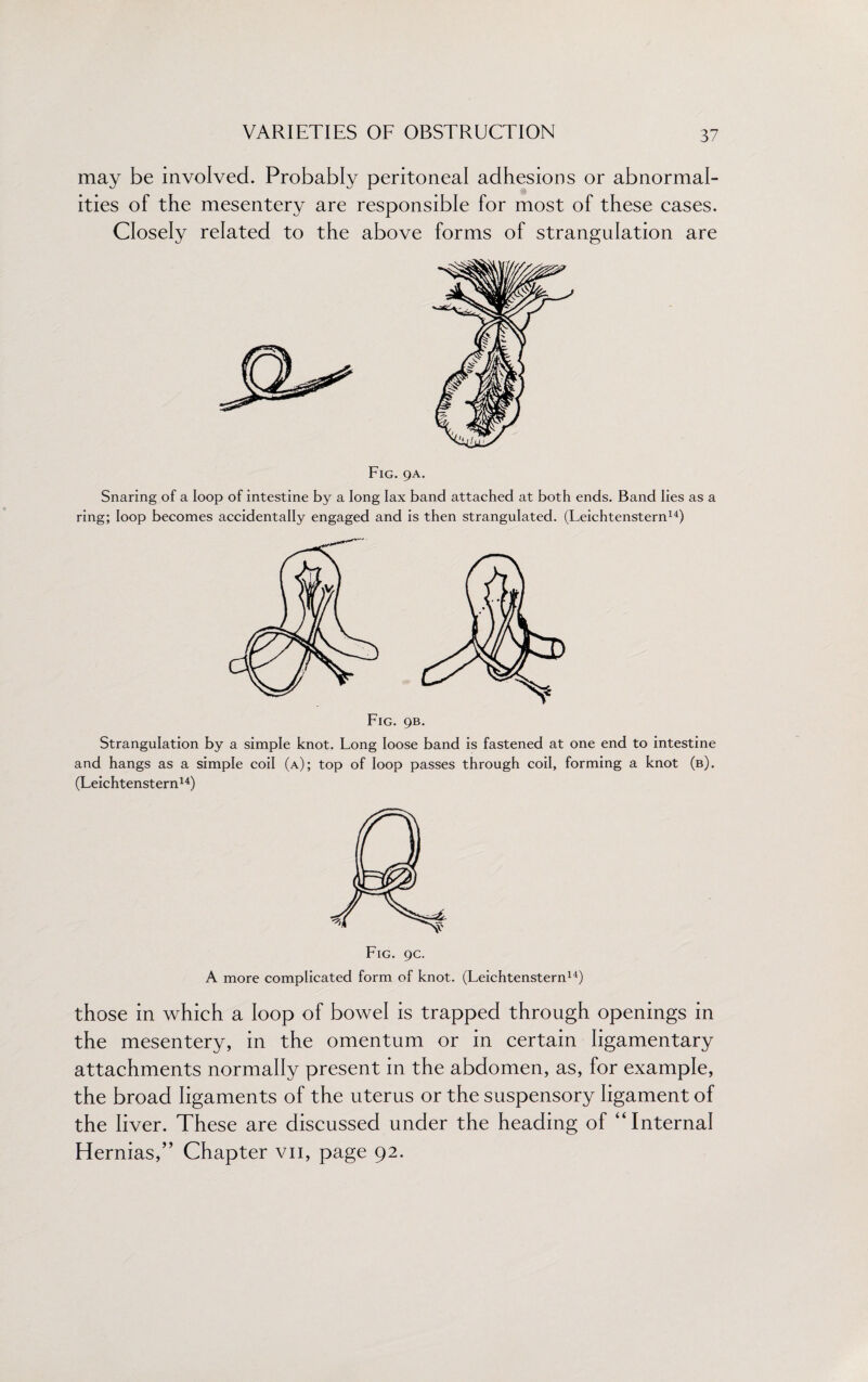 may be involved. Probably peritoneal adhesions or abnormal¬ ities of the mesentery are responsible for most of these cases. Closely related to the above forms of strangulation are Fig. 9A. Snaring of a loop of intestine by a long lax band attached at both ends. Band lies as a ring; loop becomes accidentally engaged and is then strangulated. (Leichtenstern14) Fig. 9b. Strangulation by a simple knot. Long loose band is fastened at one end to intestine and hangs as a simple coil (a); top of loop passes through coil, forming a knot (b). (Leichtenstern14) A more complicated form of knot. (Leichtenstern14) those in which a loop of bowel is trapped through openings in the mesentery, in the omentum or in certain ligamentary attachments normally present in the abdomen, as, for example, the broad ligaments of the uterus or the suspensory ligament of the liver. These are discussed under the heading of “Internal Hernias,” Chapter vn, page 92.