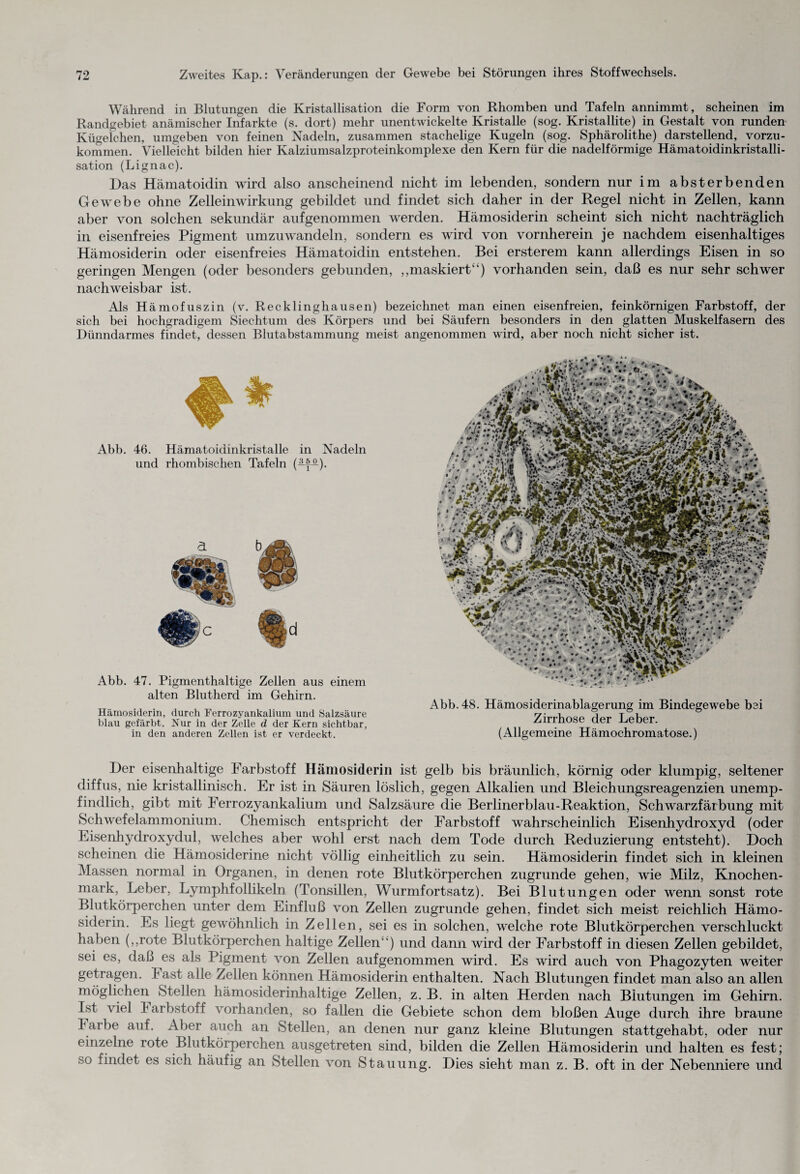 Während in Blutungen die Kristallisation die Form von Rhomben und Tafeln annimmt, scheinen im Randgebiet anämischer Infarkte (s. dort) mehr unentwickelte Kristalle (sog. Kristallite) in Gestalt von runden Kügelchen, umgeben von feinen Nadeln, zusammen stachelige Kugeln (sog. Sphärolithe) darstellend, vorzu¬ kommen. Vielleicht bilden hier Kalziumsalzproteinkomplexe den Kern für die nadelförmige Hämatoidinkristalli¬ sation (Lignac). Das Hämatoidin wird also anscheinend nicht im lebenden, sondern nur im absterbenden Gewebe ohne Zelleinwirkung gebildet und findet sich daher in der Regel nicht in Zellen, kann aber von solchen sekundär aufgenommen werden. Hämosiderin scheint sich nicht nachträglich in eisenfreies Pigment umzuwandeln, sondern es wird von vornherein je nachdem eisenhaltiges Hämosiderin oder eisenfreies Hämatoidin entstehen. Bei ersterem kann allerdings Eisen in so geringen Mengen (oder besonders gebunden, ,,maskiert“) vorhanden sein, daß es nur sehr schwer nachweisbar ist. Als Hämofuszin (v. Recklinghausen) bezeichnet man einen eisenfreien, feinkörnigen Farbstoff, der sich bei hochgradigem Siechtum des Körpers und bei Säufern besonders in den glatten Muskelfasern des Dünndarmes findet, dessen Blutabstammung meist angenommen wird, aber noch nicht sicher ist. Abb. 46. Hämatoidinkristalle in Nadeln und rhombischen Tafeln (-y^). Abb. 47. Pigmenthaltige Zellen aus einem alten Blutherd im Gehirn. Hämosiderin, durch Ferrozyankalium und Salzsäure blau gefärbt. Nur in der Zelle d der Kern sichtbar, in den anderen Zellen ist er verdeckt. Abb. 48. Hämosiderinablagerung im Bindegewebe bei Zirrhose der Leber. (Allgemeine Hämochromatose.) Der eisenhaltige Farbstoff Hämosiderin ist gelb bis bräunlich, körnig oder klumpig, seltener diffus, nie kristallinisch. Er ist in Säuren löslich, gegen Alkalien und Bleichungsreagenzien unemp¬ findlich, gibt mit Ferrozyankalium und Salzsäure die Berlinerblau-Reaktion, Schwarzfärbung mit Schwefelammonium. Chemisch entspricht der Farbstoff wahrscheinlich Eisenhydroxyd (oder Eisenhydroxydul, welches aber wohl erst nach dem Tode durch Reduzierung entsteht). Doch scheinen die Hämosiderine nicht völlig einheitlich zu sein. Hämosiderin findet sich in kleinen Massen normal in Organen, in denen rote Blutkörperchen zugrunde gehen, wie Milz, Knochen¬ mark, Leber, Lymphfollikeln (Tonsillen, Wurmfortsatz). Bei Blutungen oder wenn sonst rote Blutkörperchen unter dem Einfluß von Zellen zugrunde gehen, findet sich meist reichlich Hämo¬ siderin. Es liegt gewöhnlich in Zellen, sei es in solchen, welche rote Blutkörperchen verschluckt haben („rote Blutkörperchen haltige Zellen ) und dann wird der Farbstoff in diesen Zellen gebildet, sei es, daß es als Pigment von Zellen aufgenommen wird. Es wird auch von Phagozyten weiter getragen, hast alle Zellen können Hämosiderin enthalten. Nach Blutungen findet man also an allen möglichen Stellen hämosiderinhaltige Zellen, z. B. in alten Herden nach Blutungen im Gehirn. Ist viel Farbstoff vorhanden, so fallen die Gebiete schon dem bloßen Auge durch ihre braune Farbe auf. Aber auch an Stellen, an denen nur ganz kleine Blutungen stattgehabt, oder nur einzelne rote Blutkörperchen ausgetreten sind, bilden die Zellen Hämosiderin und halten es fest; so findet es sich häufig an Stellen von Stauung. Dies sieht man z. B. oft in der Nebenniere und